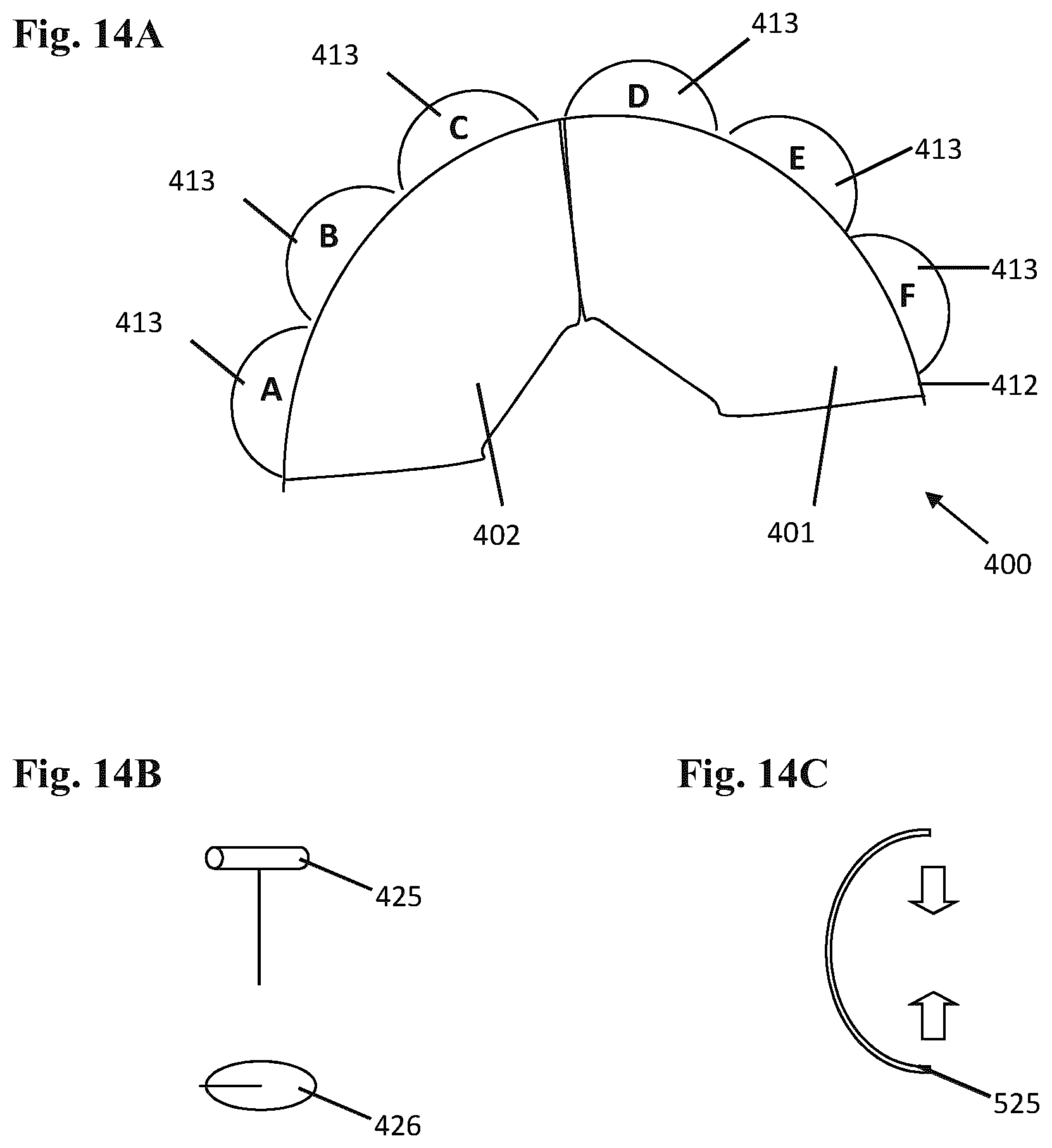 Patent US12102532 Figure 11 – Systems and methods for treating luminal valves