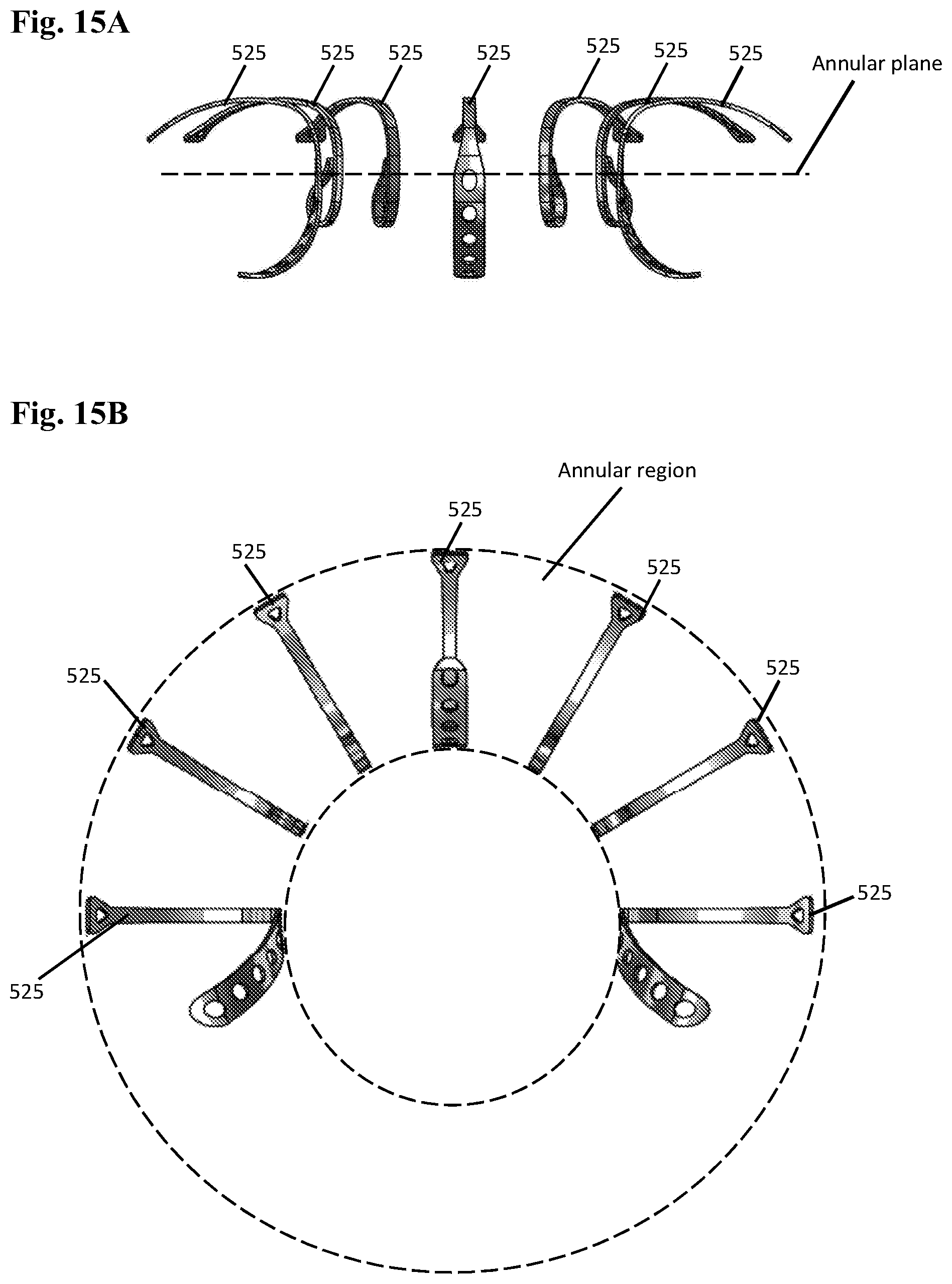 Patent US12102532 Figure 12 – Systems and methods for treating luminal valves