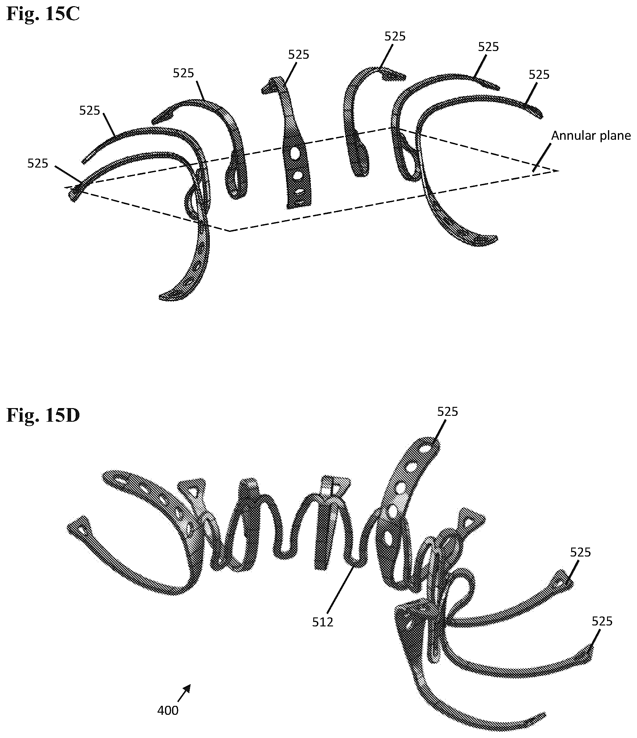 Patent US12102532 Figure 13 – Systems and methods for treating luminal valves
