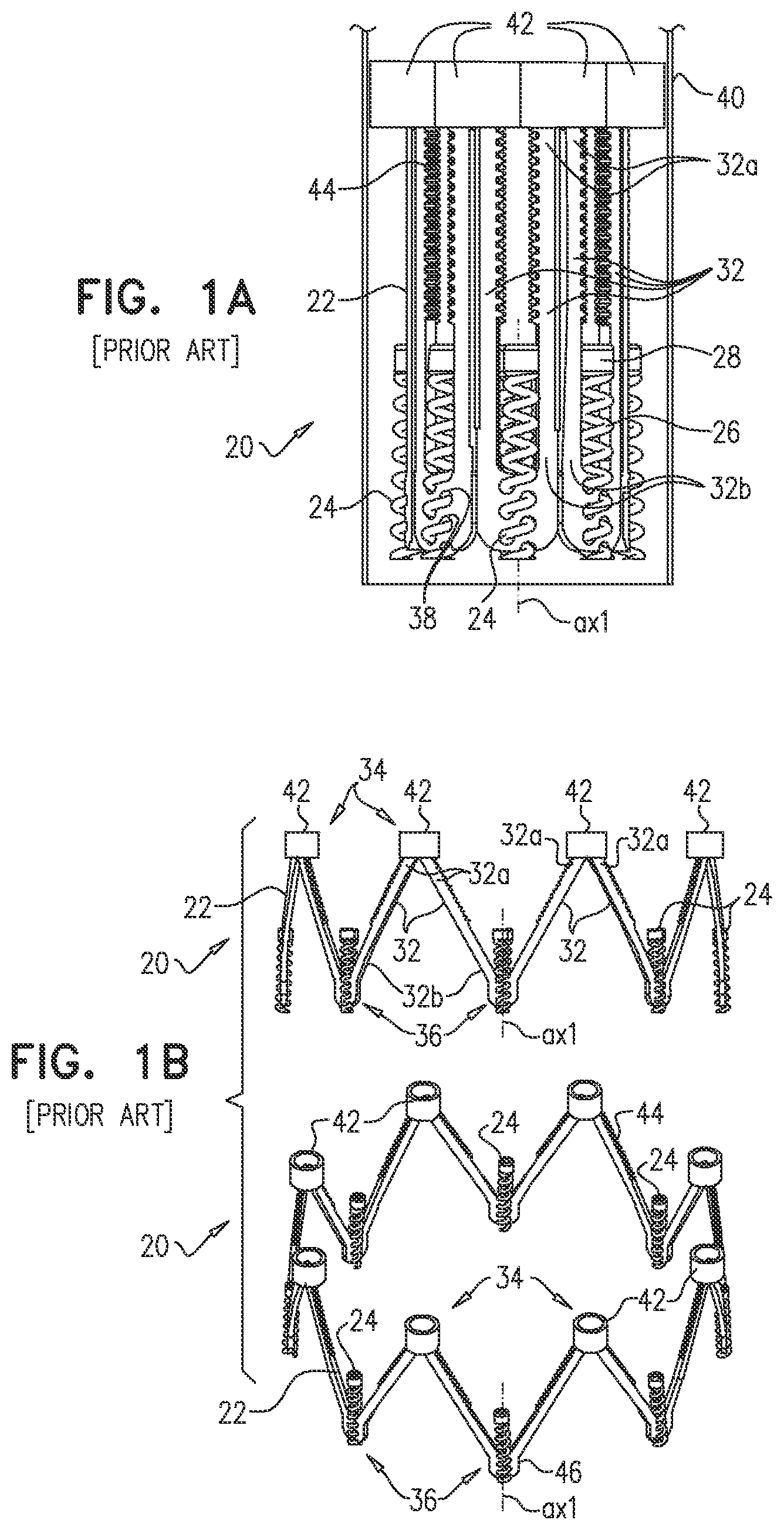 Patent US12102533 — Adjustable annuloplasty device with alternating peaks and troughs — Figure 1