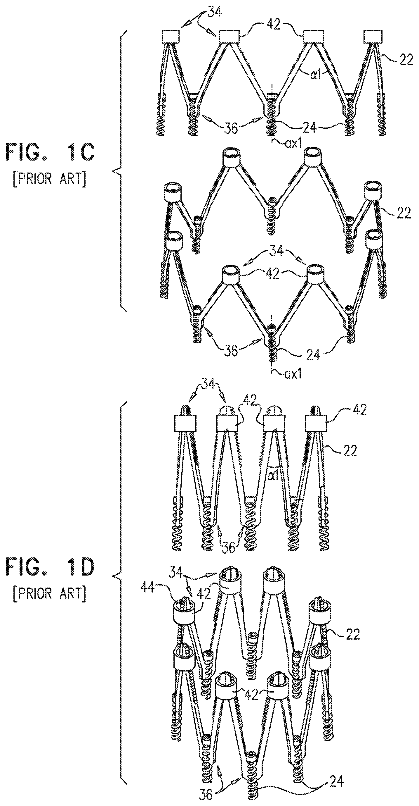 Patent US12102533 Figure 2 – Adjustable annuloplasty device with alternating peaks and troughs