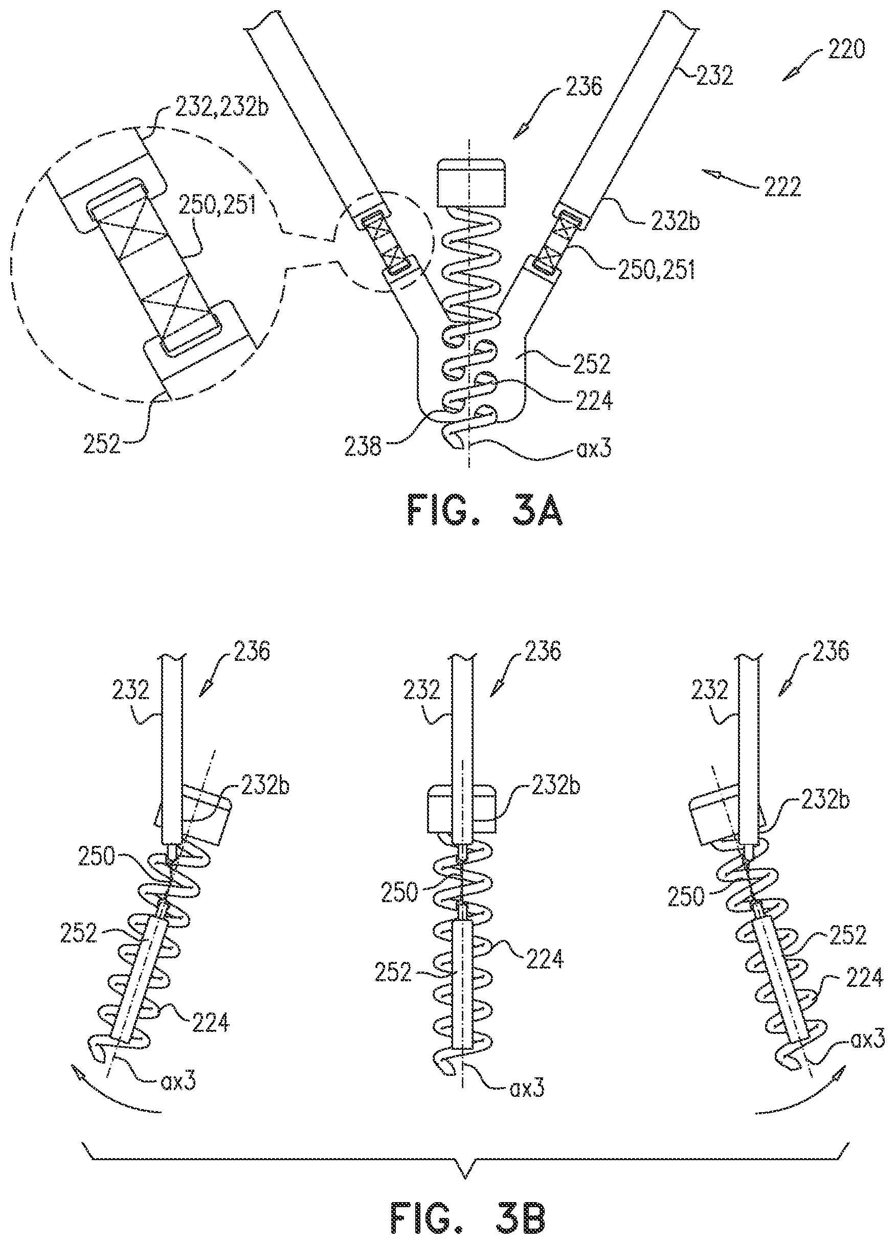 Patent US12102533 Figure 4 – Adjustable annuloplasty device with alternating peaks and troughs