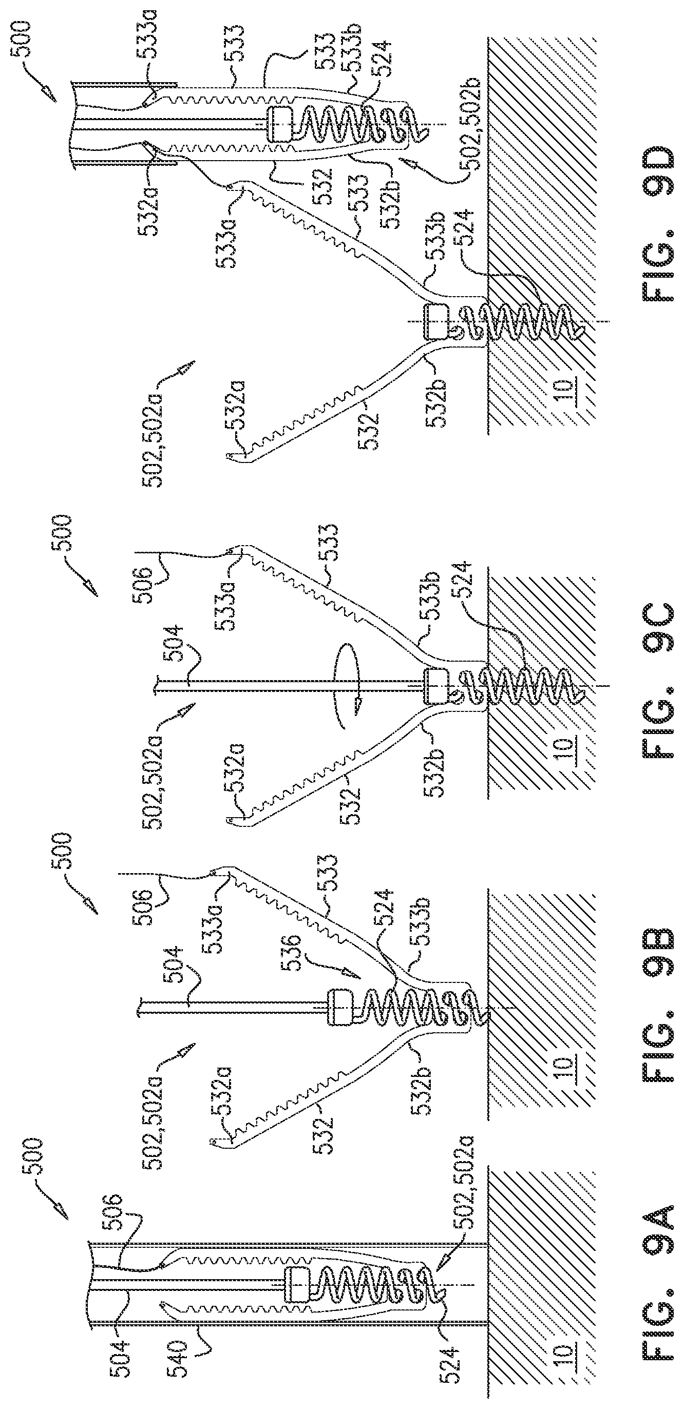 Patent US12102533 Figure 8 – Adjustable annuloplasty device with alternating peaks and troughs