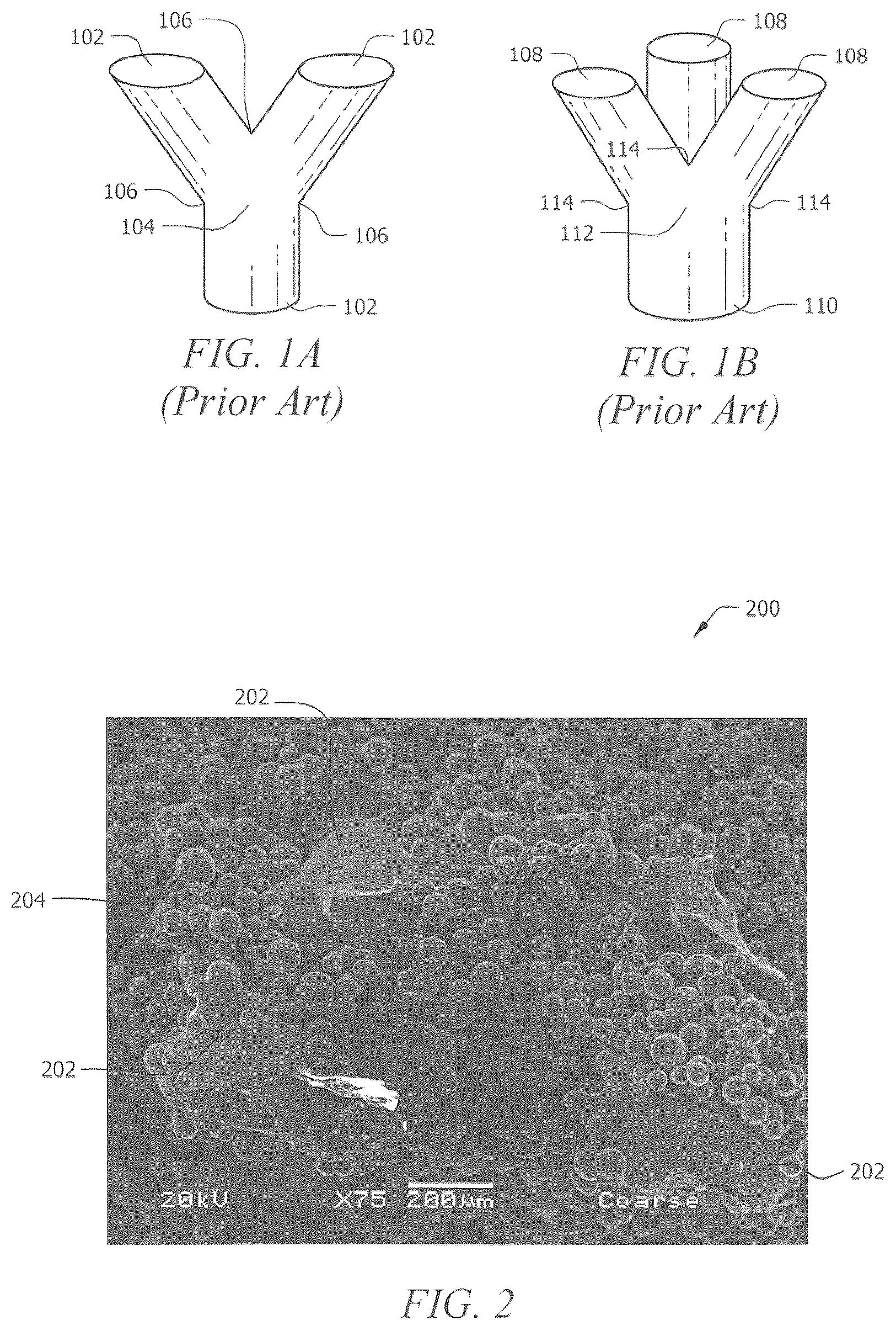 Patent US12102536 Figure 1 – Porous implant structures