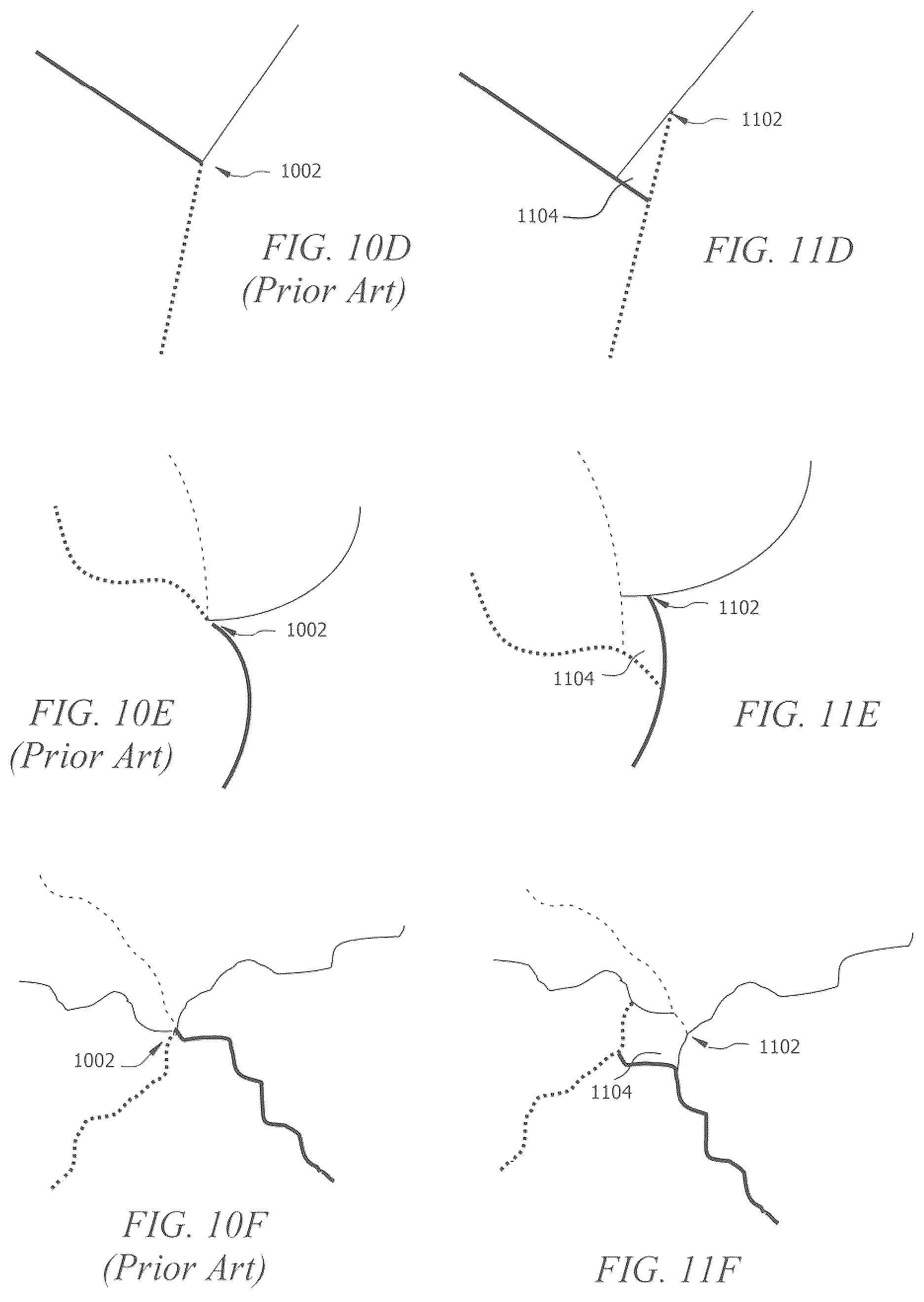 Patent US12102536 Figure 5 – Porous implant structures