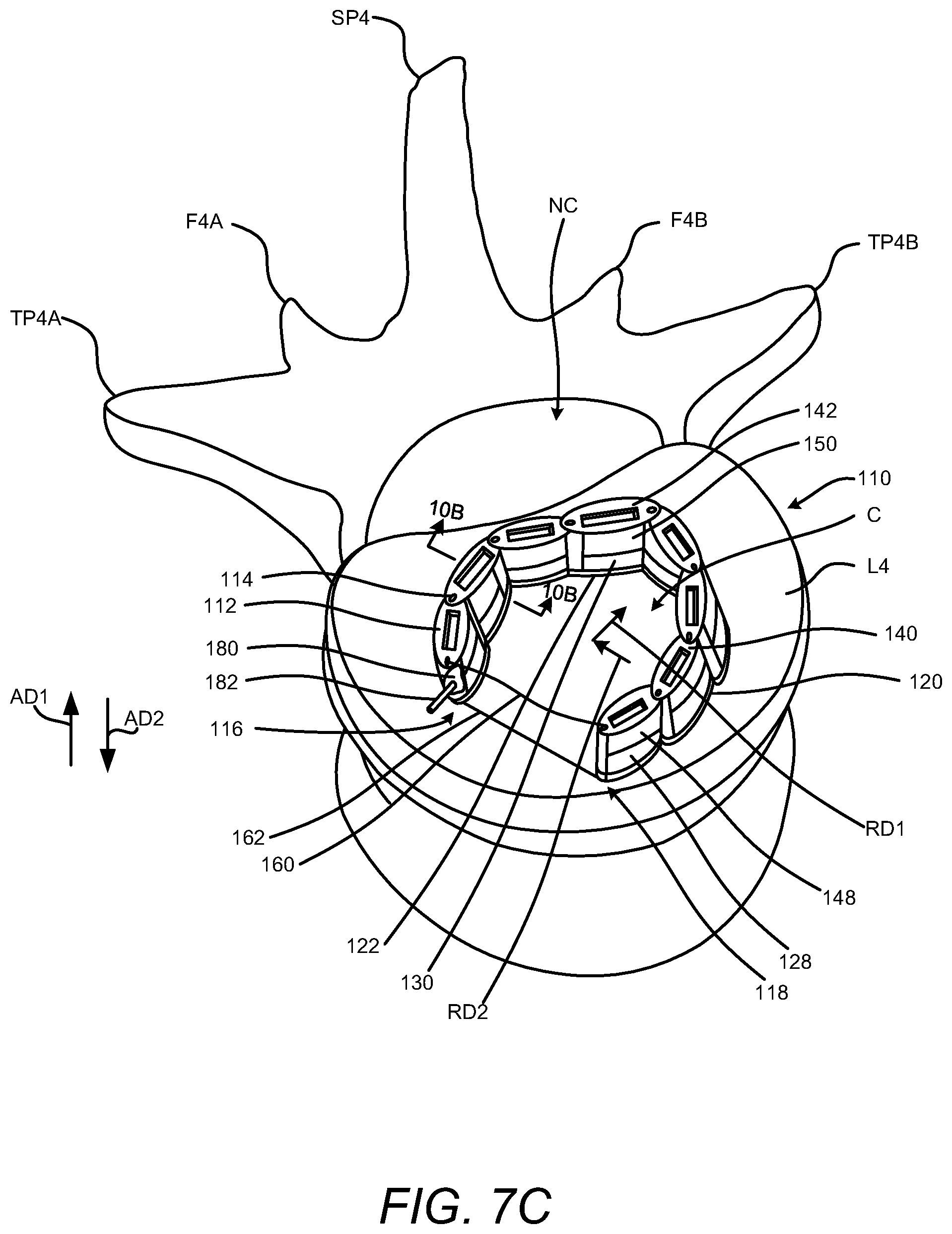 Patent US12102537 Figure 9 – Minimally invasive expandable intervertebral fusion implant