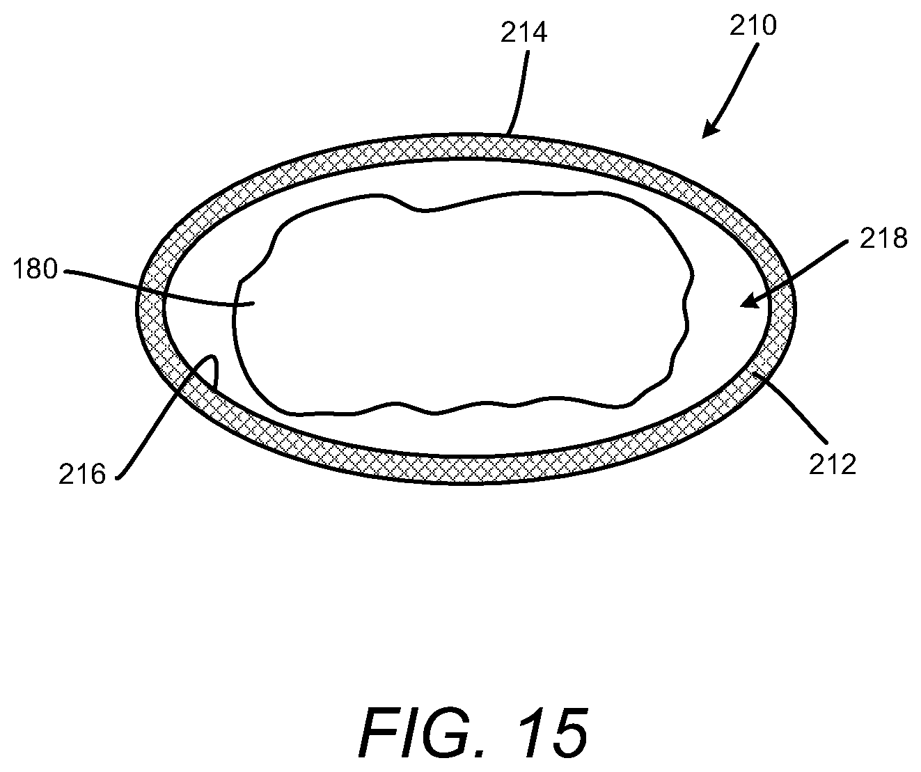 Patent US12102537 Figure 15 – Minimally invasive expandable intervertebral fusion implant