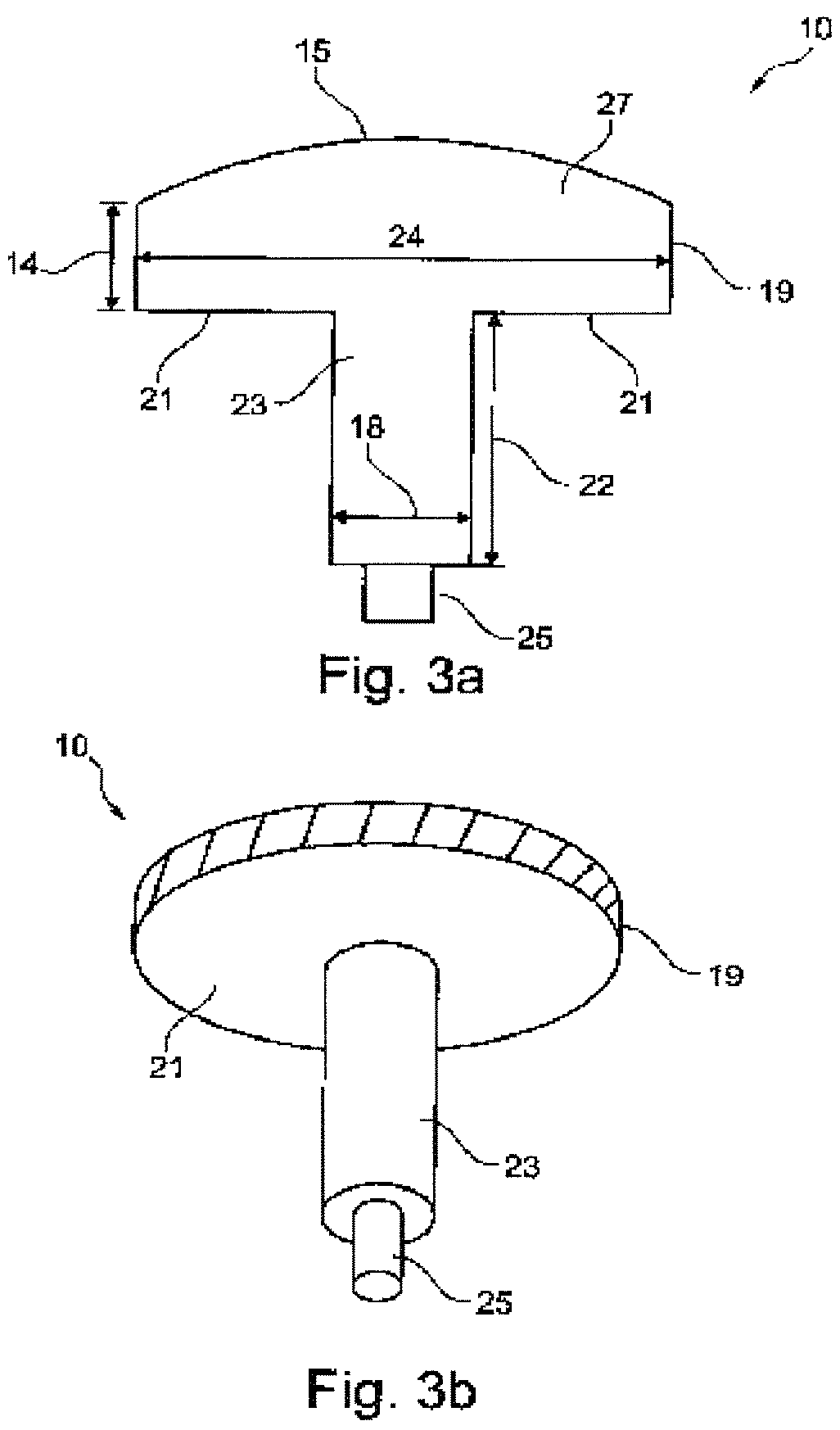 Patent US12102540 Figure 3 – System of designing a guide tool and/or surgical kit tools and/or an implant comprising a positioning mark