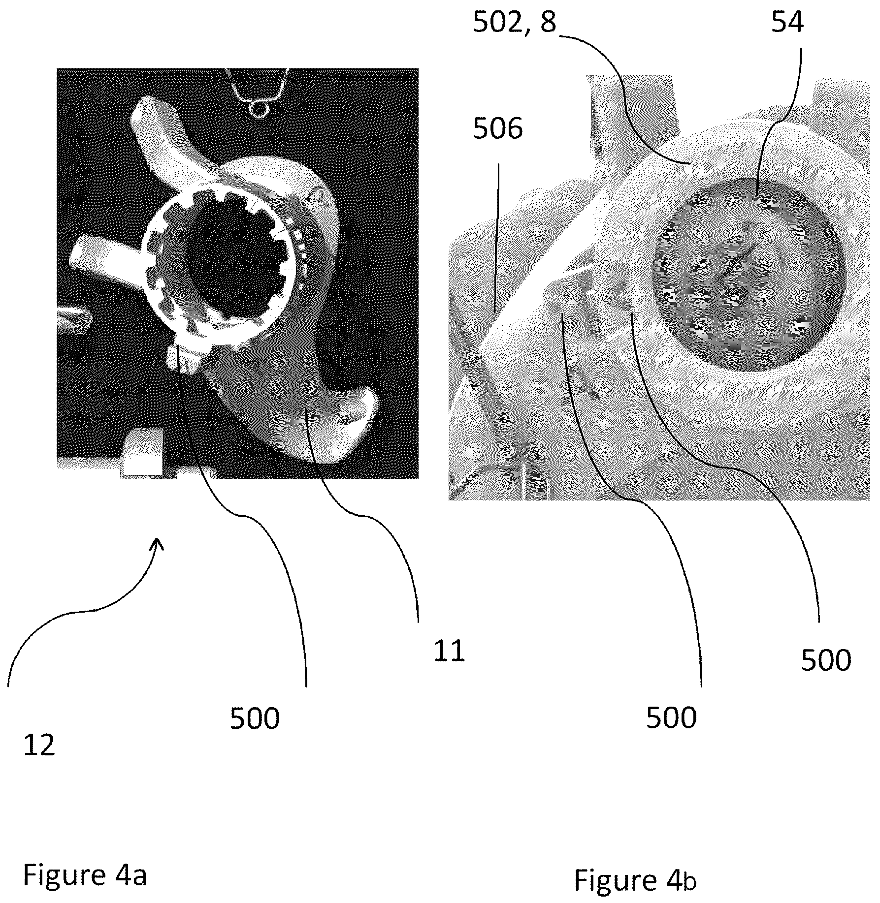 Patent US12102540 Figure 4 – System of designing a guide tool and/or surgical kit tools and/or an implant comprising a positioning mark