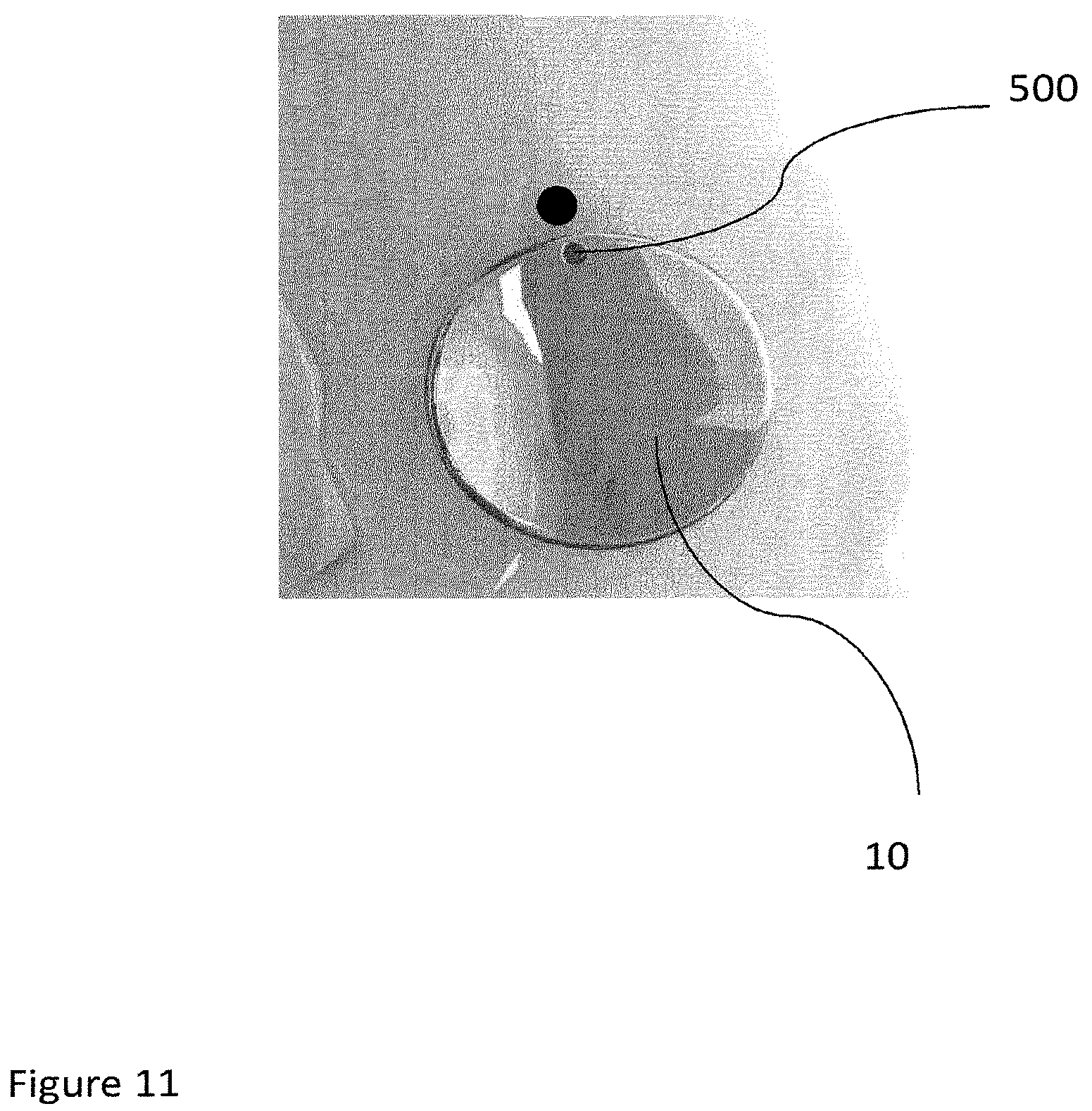 Patent US12102540 Figure 11 – System of designing a guide tool and/or surgical kit tools and/or an implant comprising a positioning mark