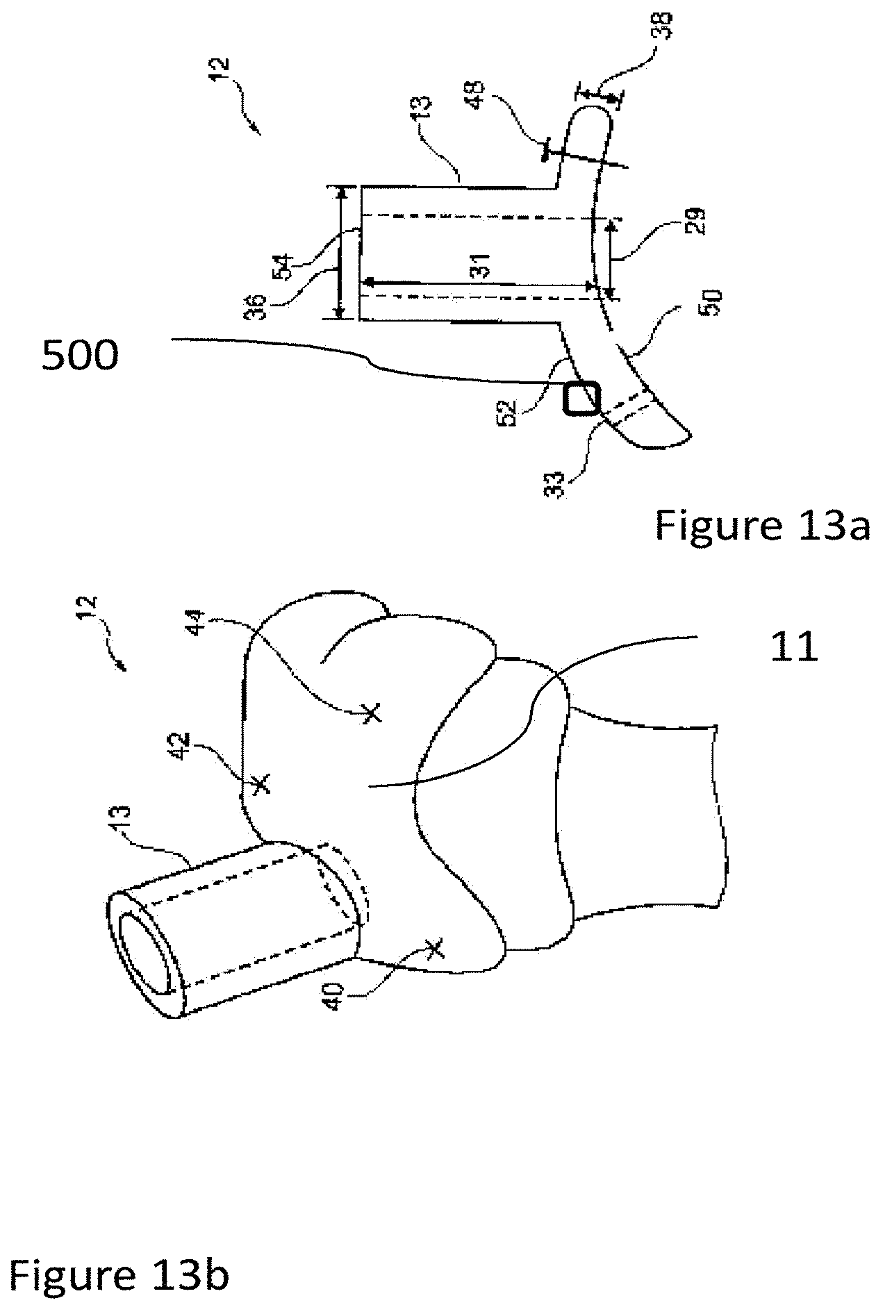 Patent US12102540 Figure 13 – System of designing a guide tool and/or surgical kit tools and/or an implant comprising a positioning mark