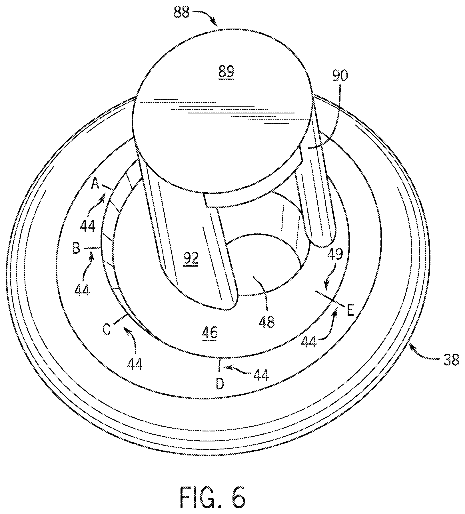 Patent US12102541 Figure 5 – Shoulder prosthesis with variable inclination humeral head component