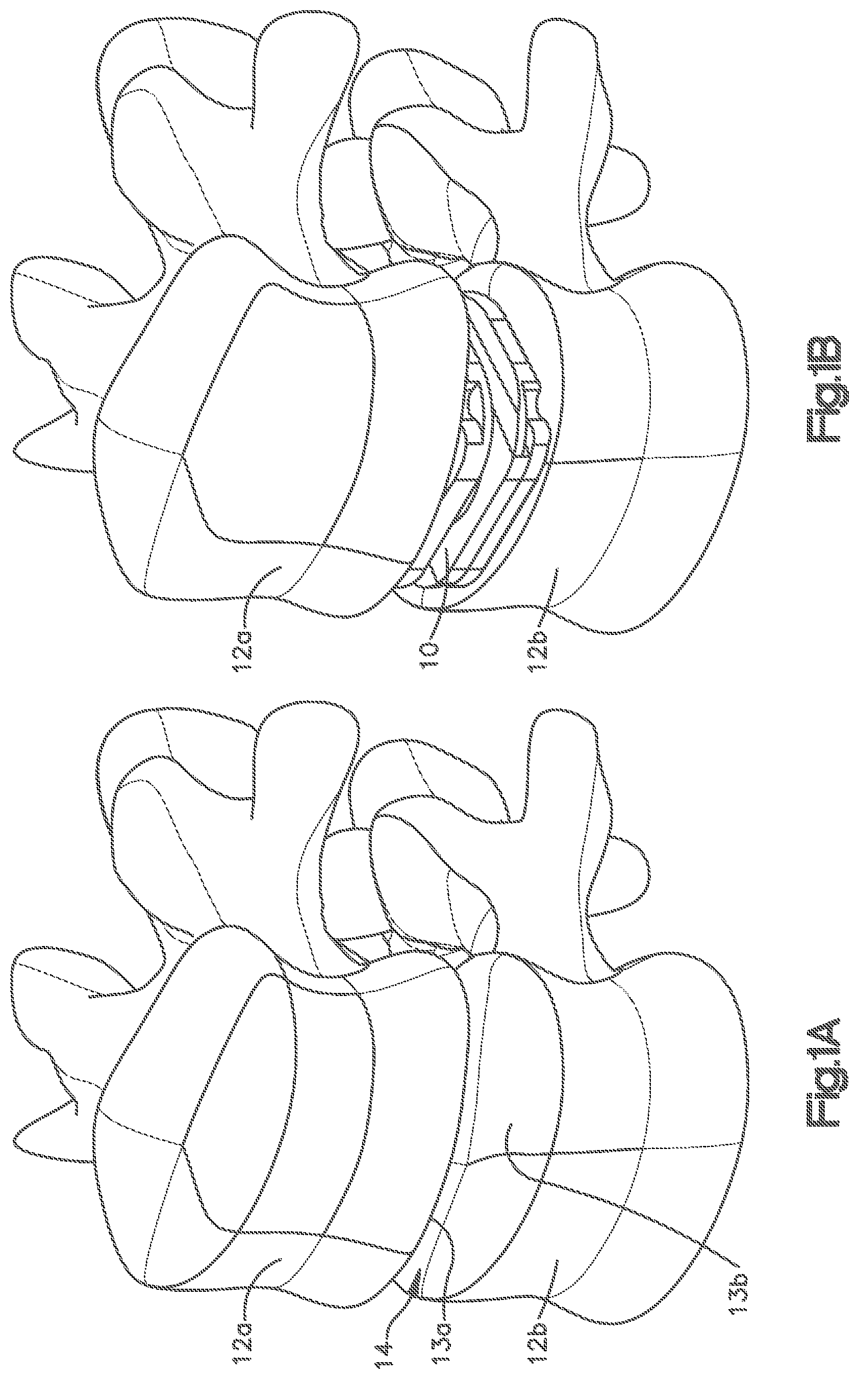 Patent US12102543 — Inter vertebral implant — Figure 1