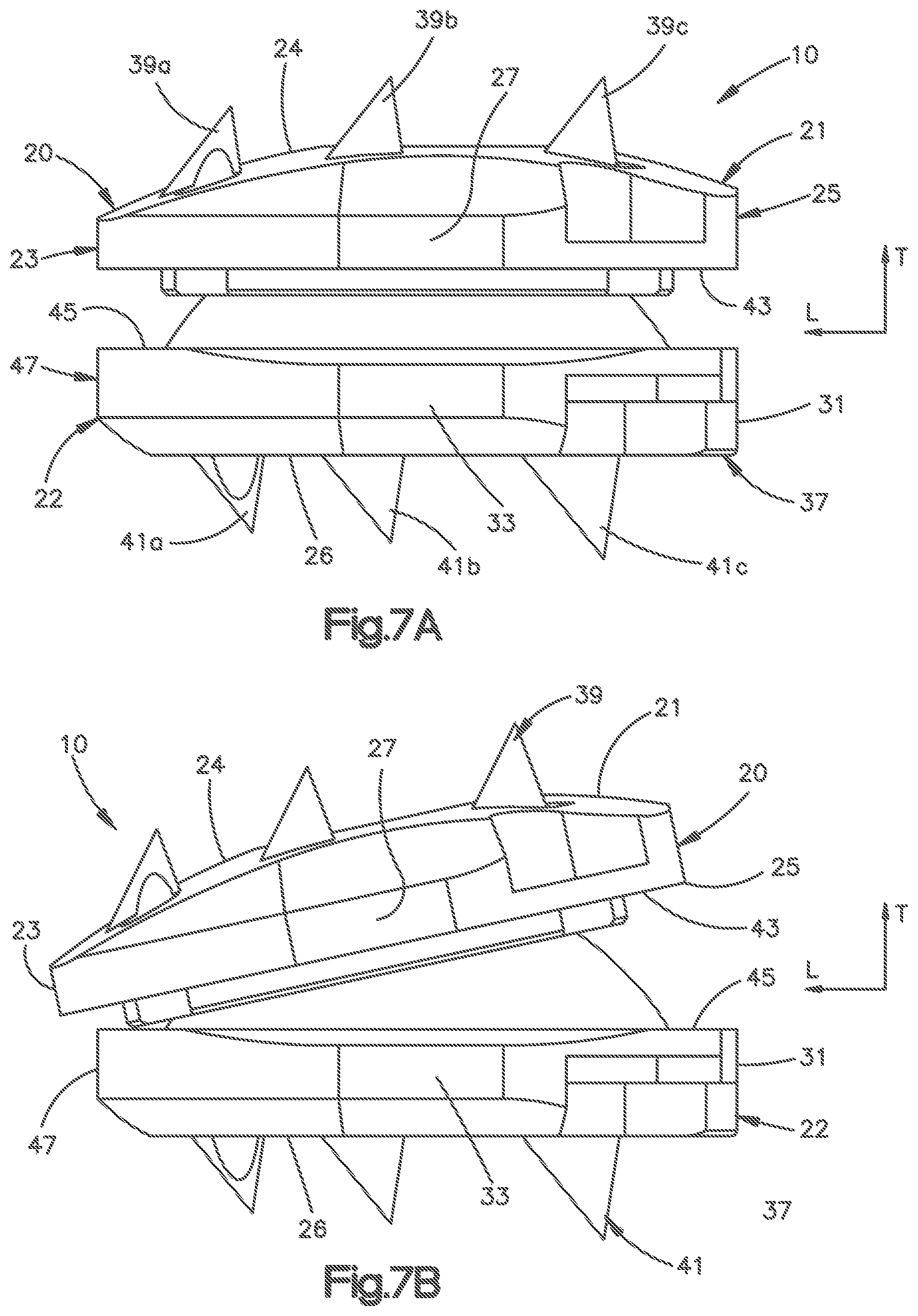 Patent US12102543 Figure 6 – Inter vertebral implant