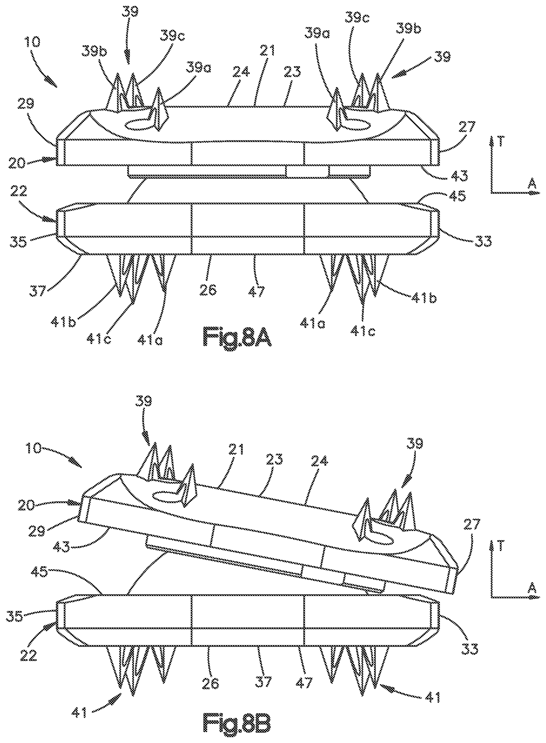 Patent US12102543 Figure 7 – Inter vertebral implant
