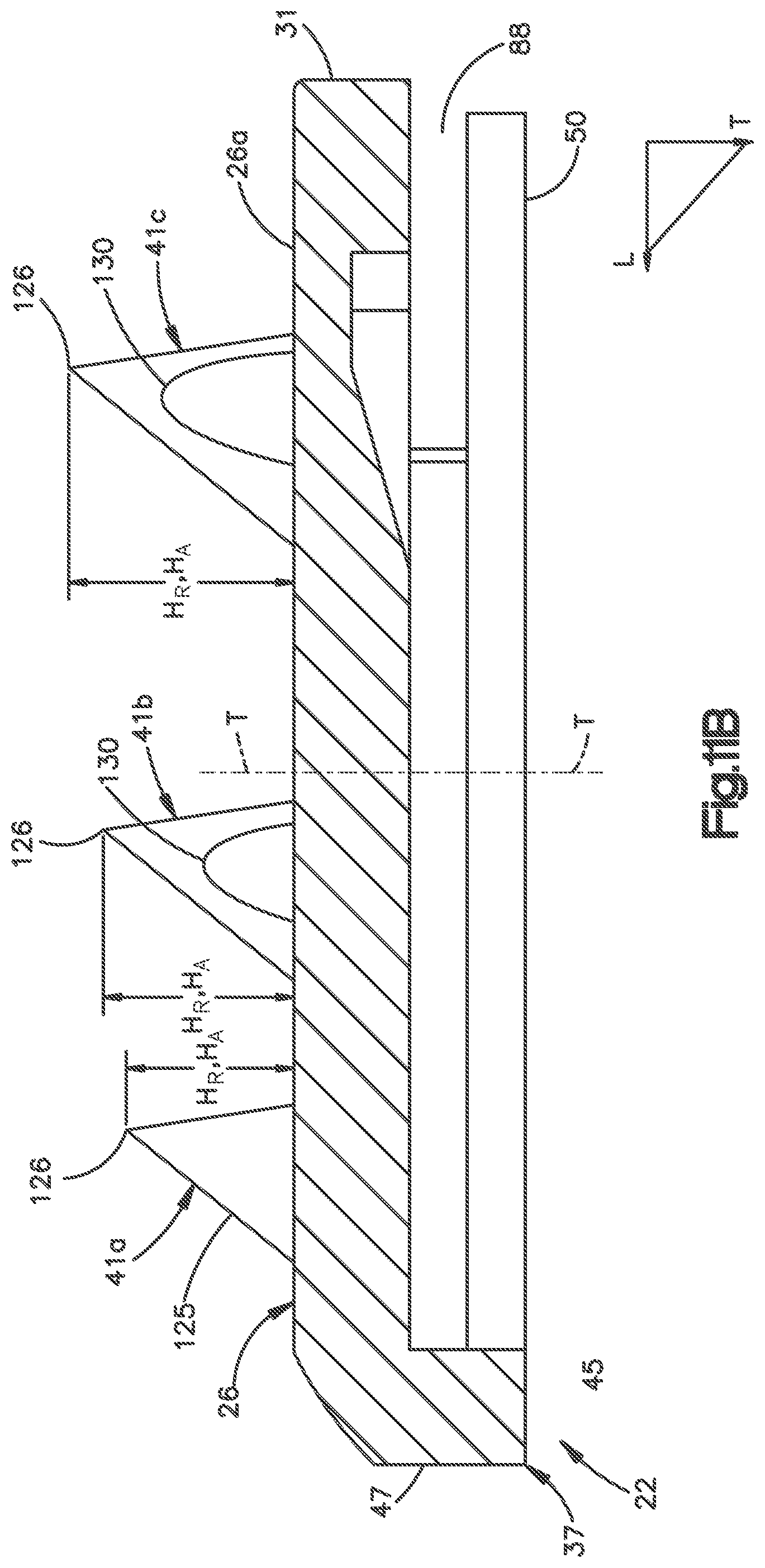 Patent US12102543 Figure 14 – Inter vertebral implant