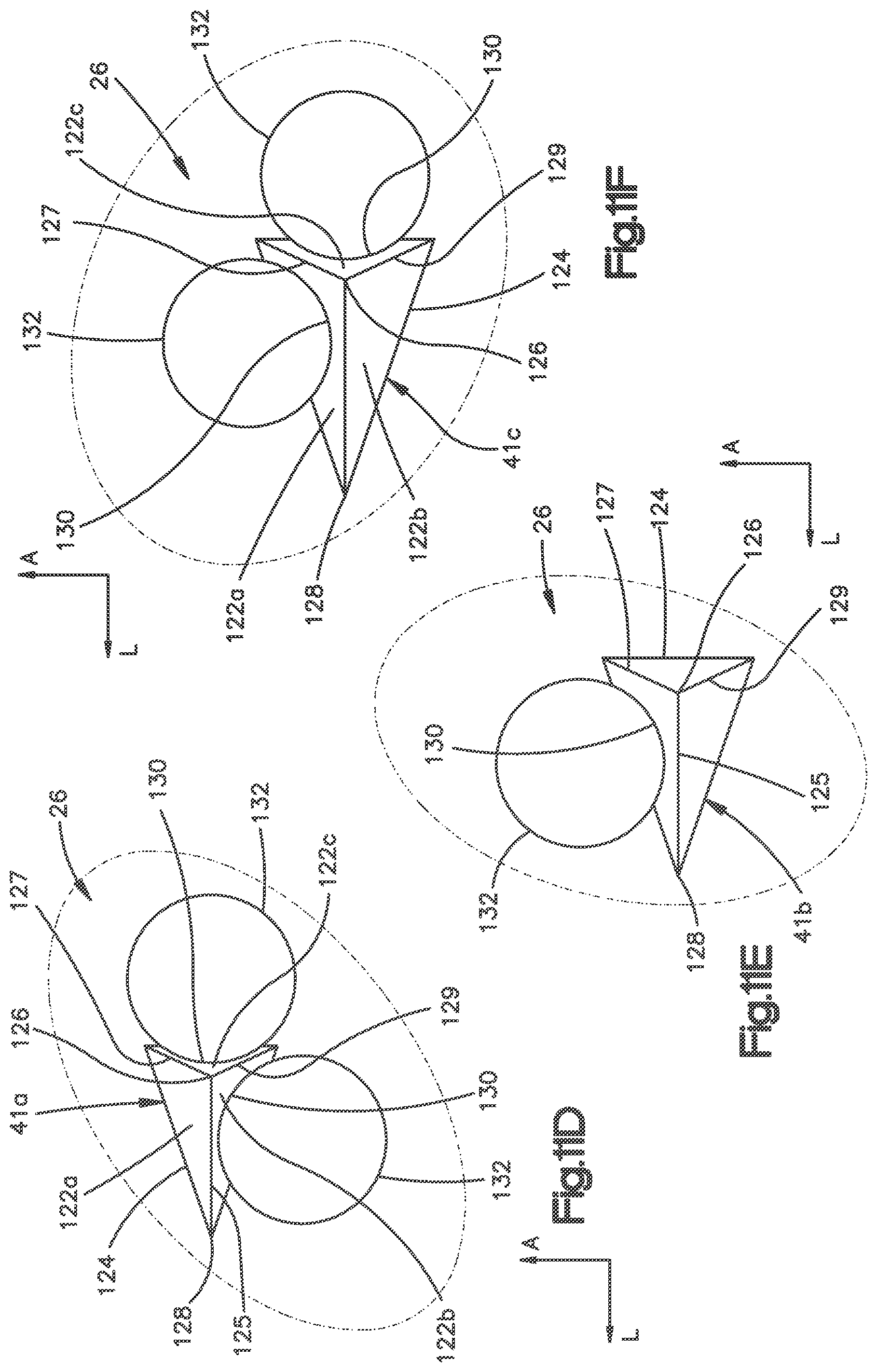 Patent US12102543 Figure 16 – Inter vertebral implant