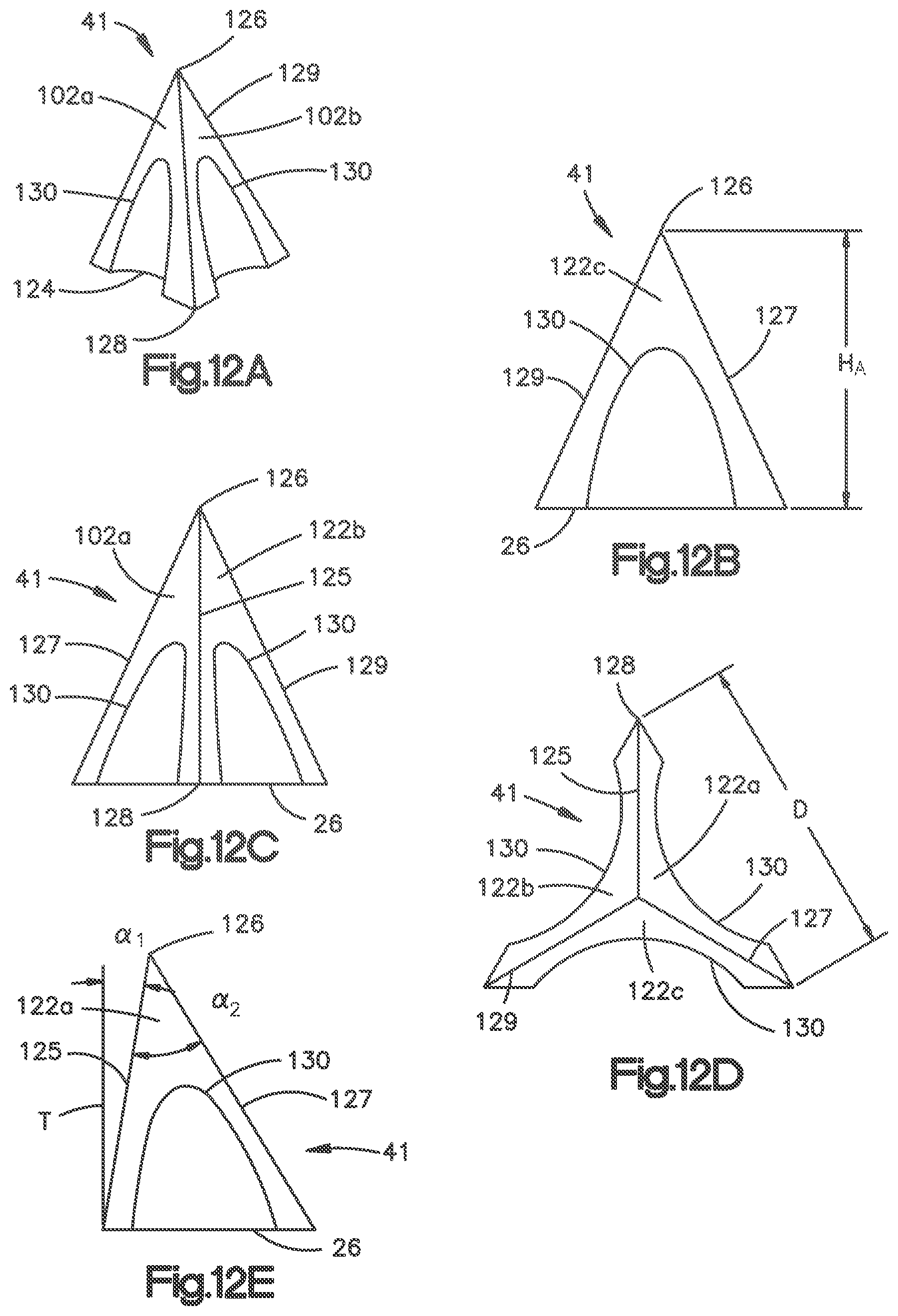 Patent US12102543 Figure 17 – Inter vertebral implant