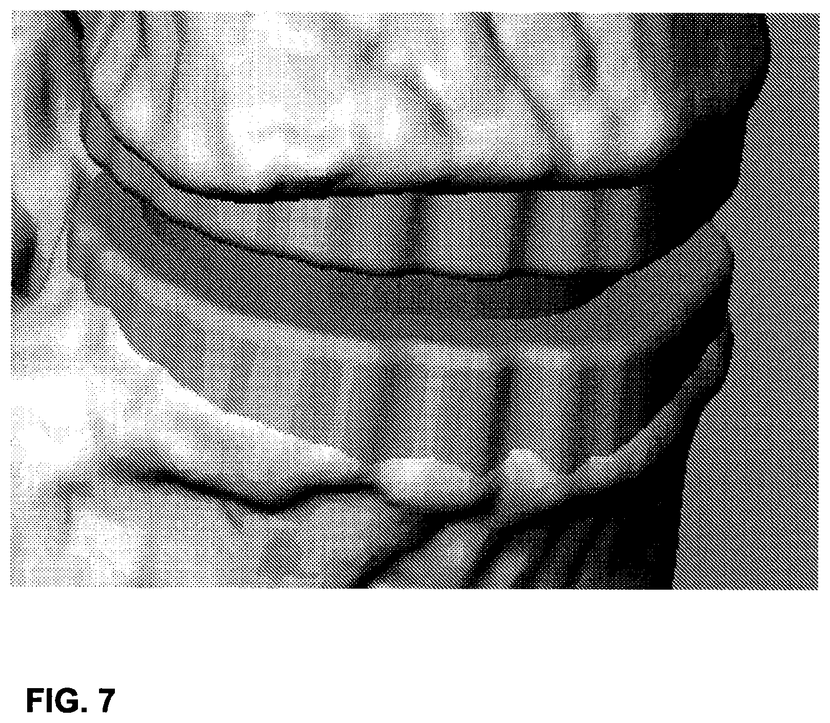 Patent US12102544 Figure 8 – Bio-mechanically compatible 3D-printed intervertebral disk