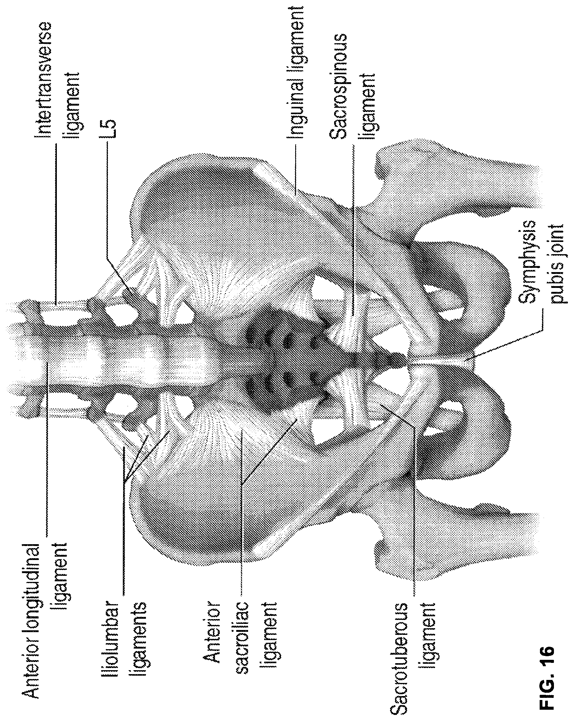 Patent US12102544 Figure 18 – Bio-mechanically compatible 3D-printed intervertebral disk