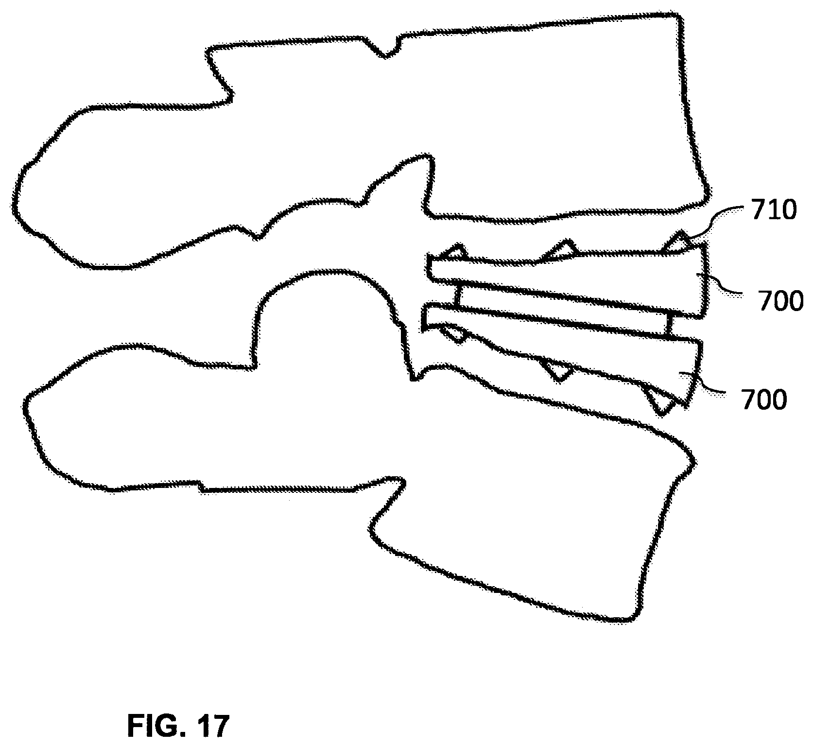 Patent US12102544 Figure 19 – Bio-mechanically compatible 3D-printed intervertebral disk