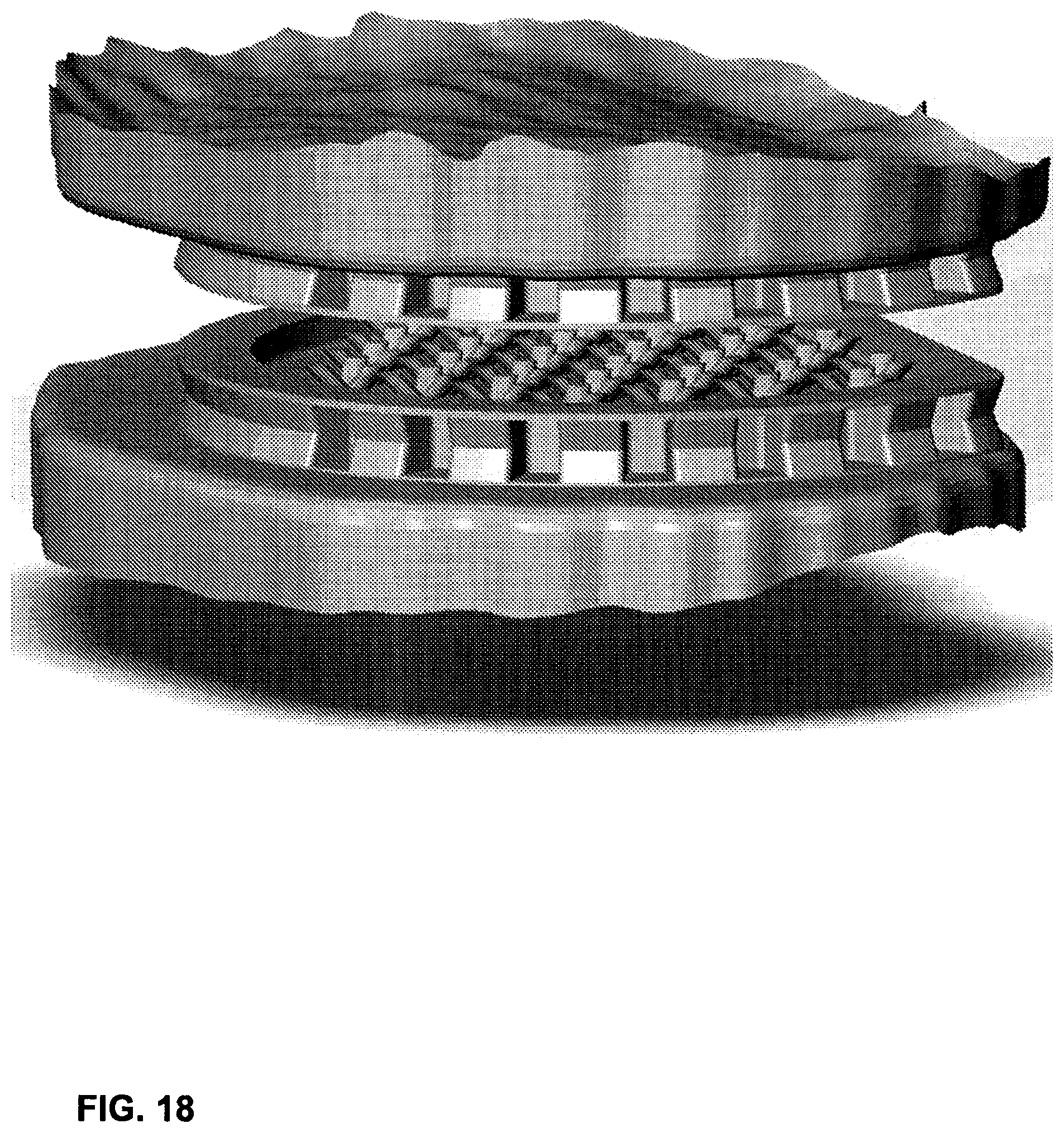 Patent US12102544 Figure 20 – Bio-mechanically compatible 3D-printed intervertebral disk
