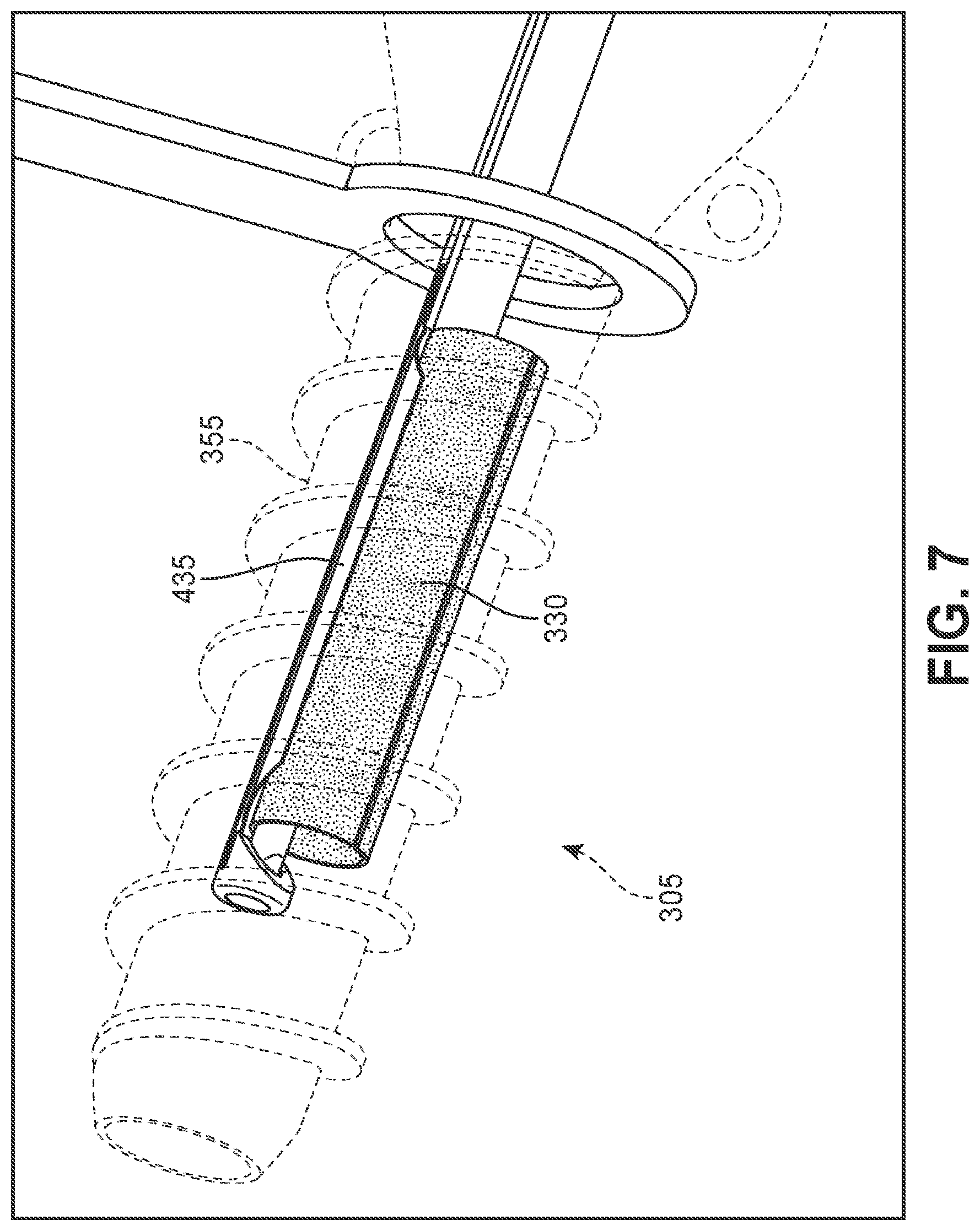 Patent US12102545 Figure 7 – Implant delivery device