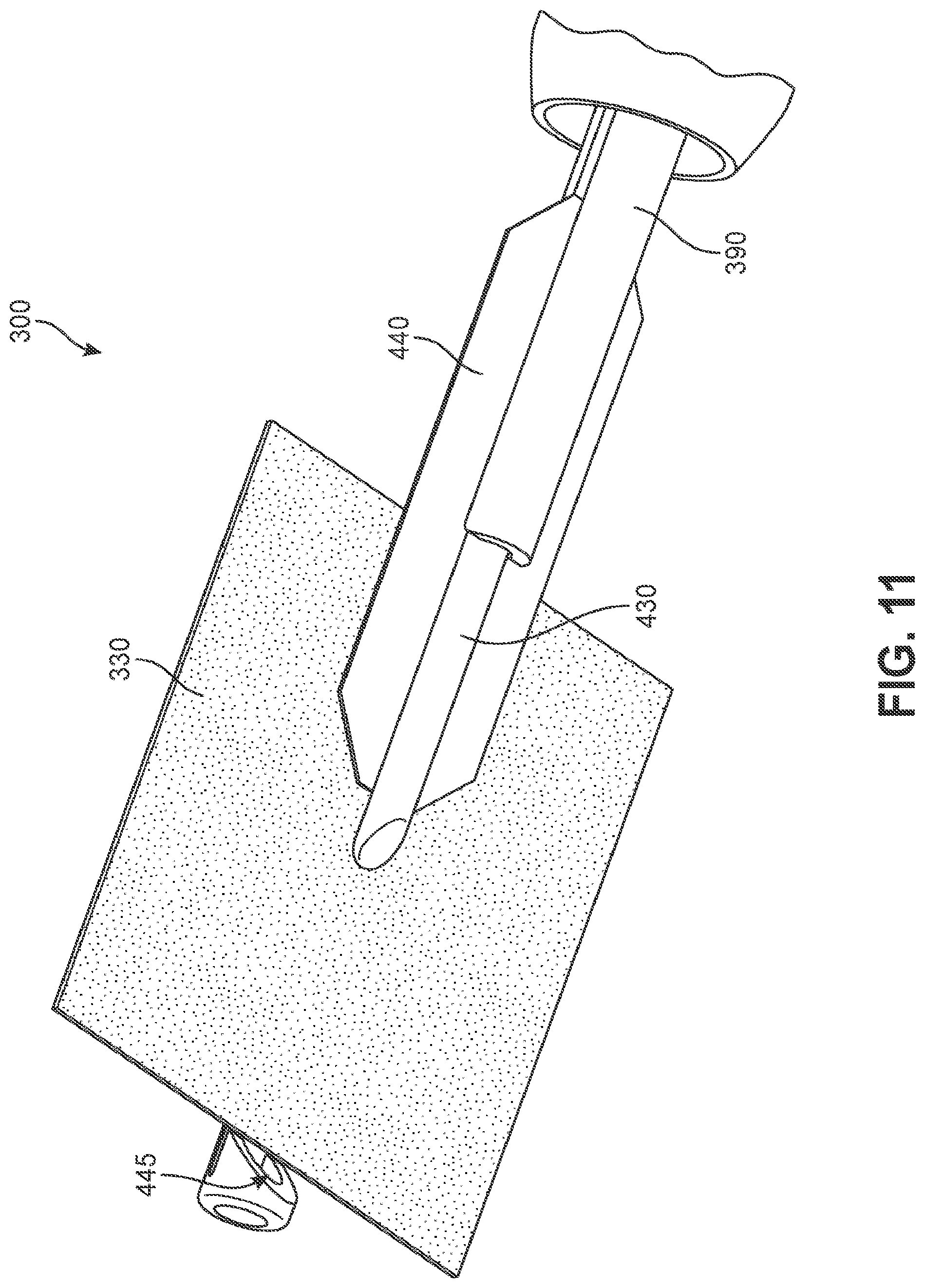 Patent US12102545 Figure 11 – Implant delivery device