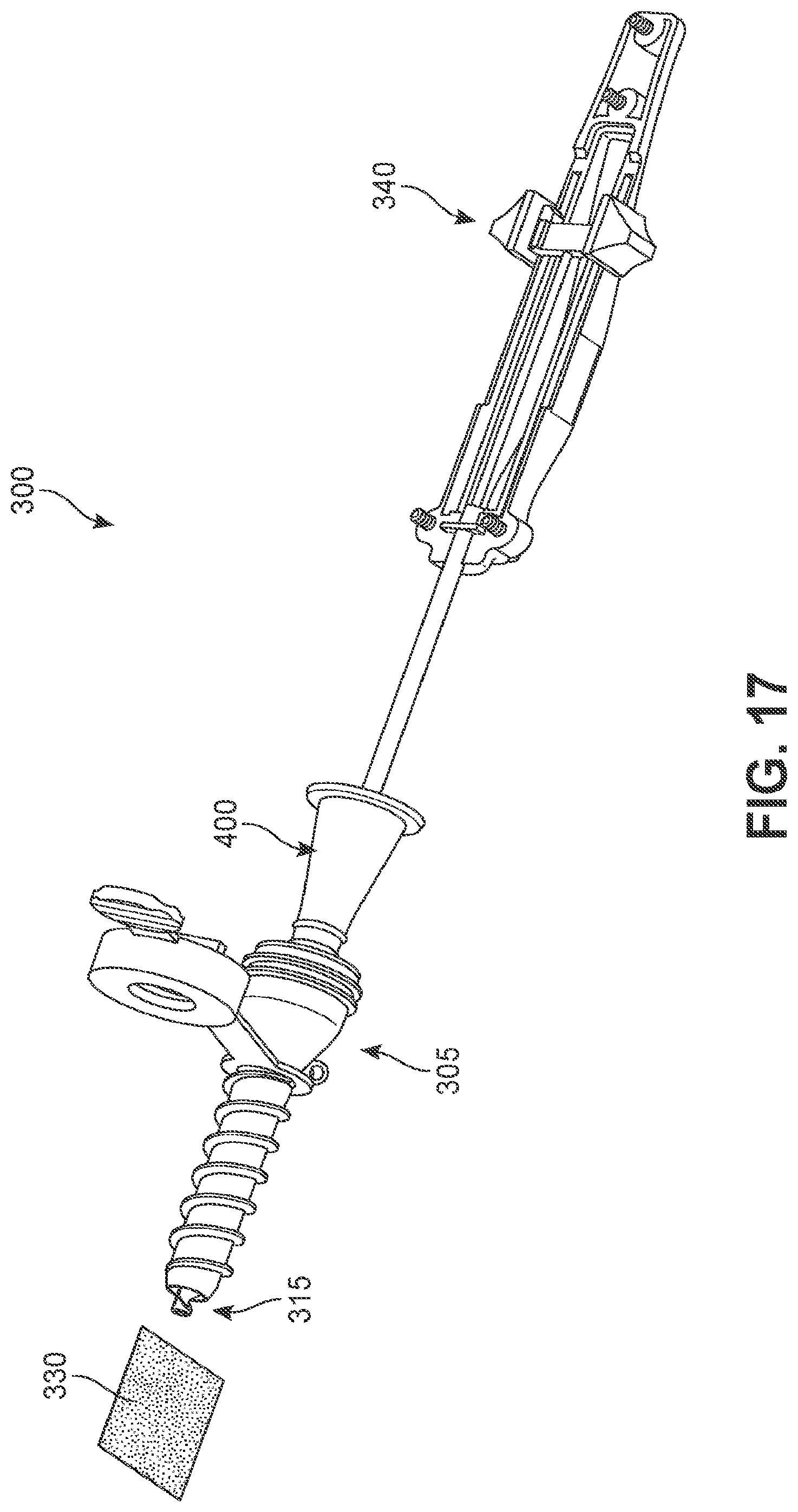 Patent US12102545 Figure 17 – Implant delivery device
