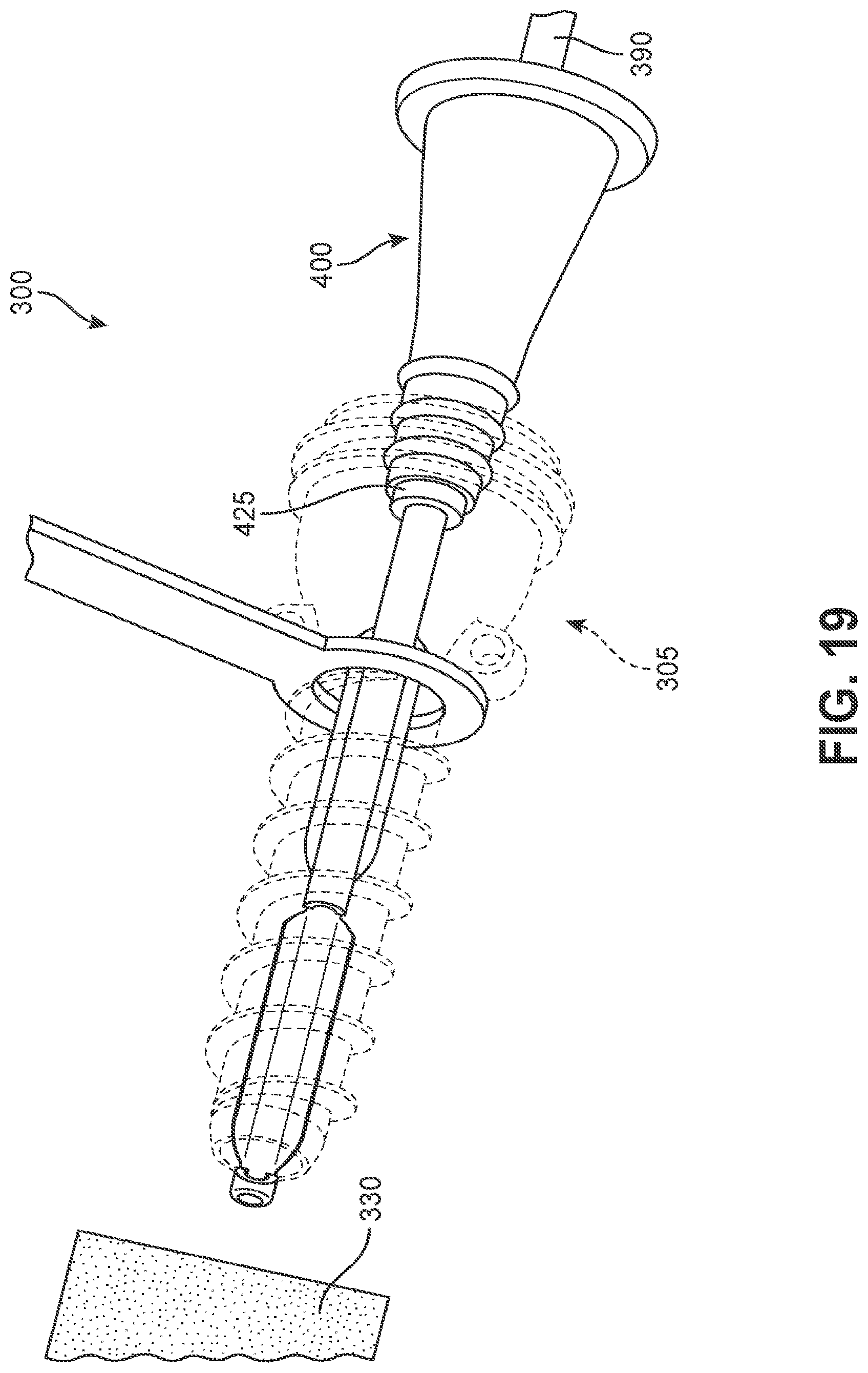 Patent US12102545 Figure 19 – Implant delivery device