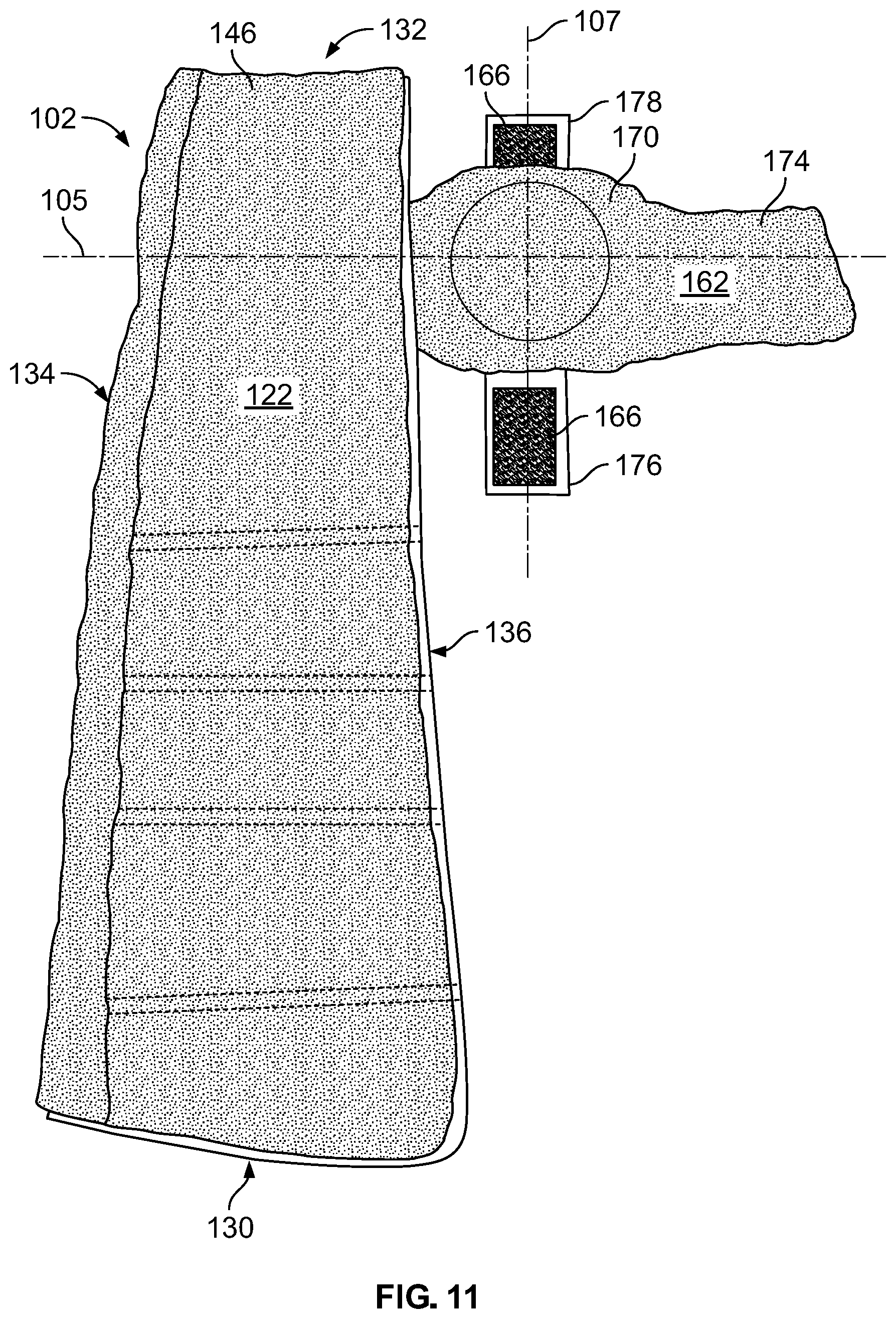 Patent US12102548 Figure 9 – Leg protector for above-knee amputation