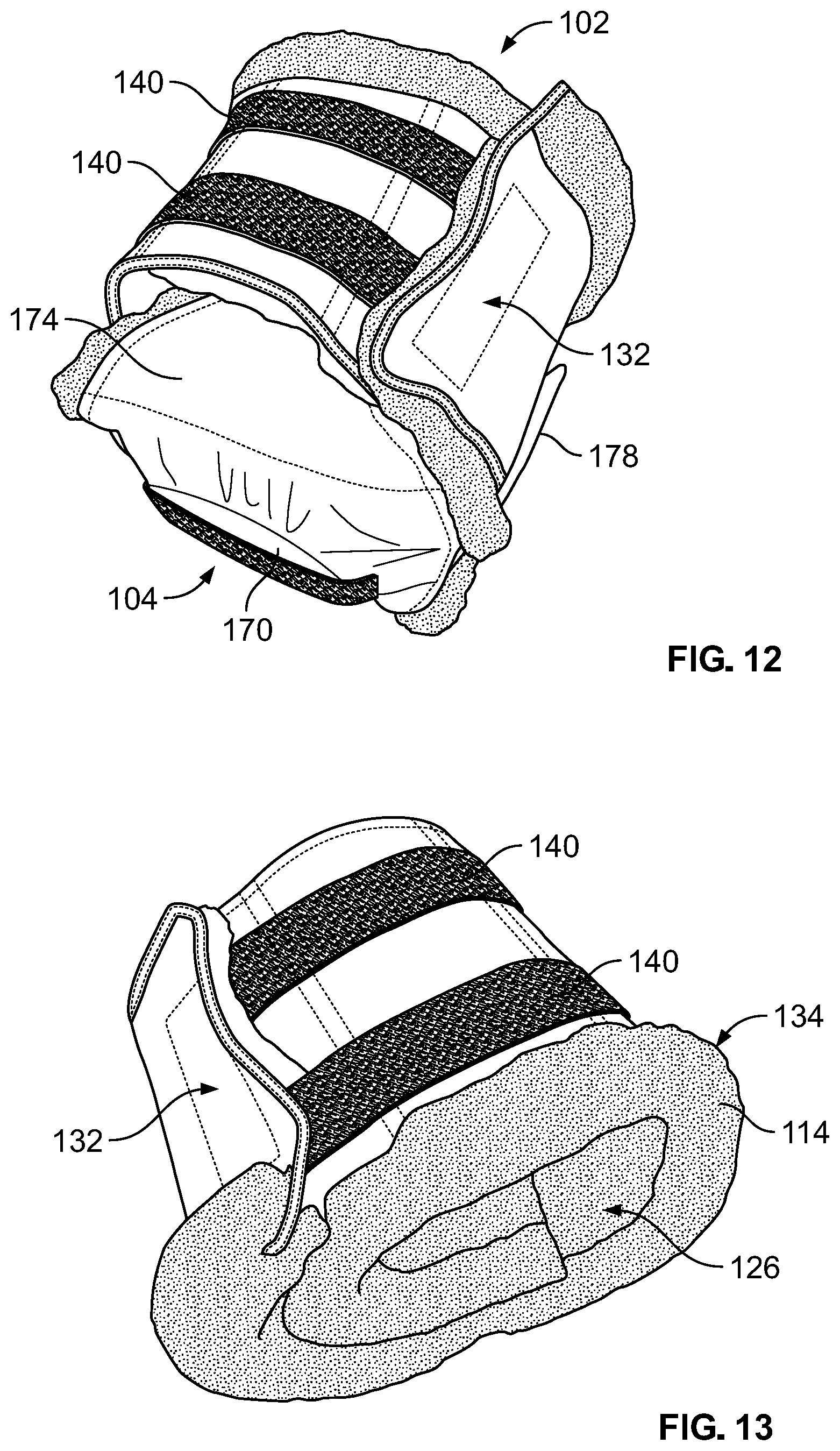 Patent US12102548 Figure 10 – Leg protector for above-knee amputation