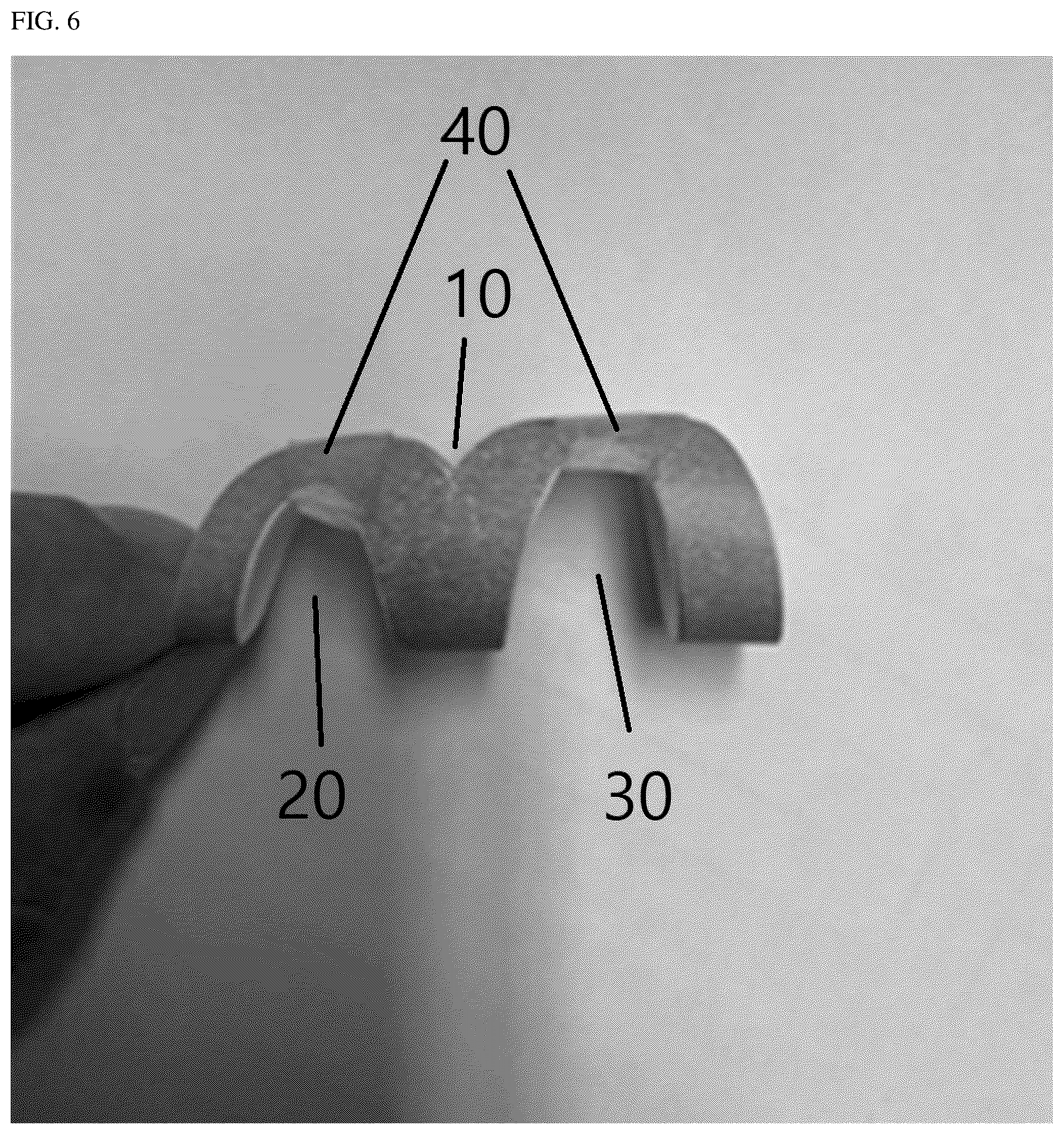 Patent US12102551 Figure 6 – Finger splint for manual therapy