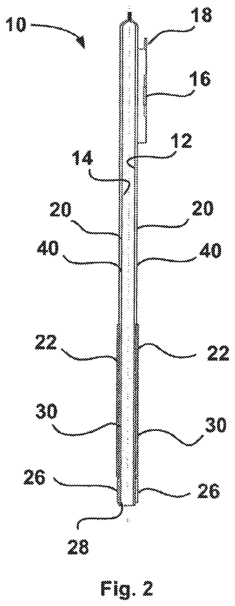 Patent US12102553 Figure 2 – Closure system for a drainable pouch