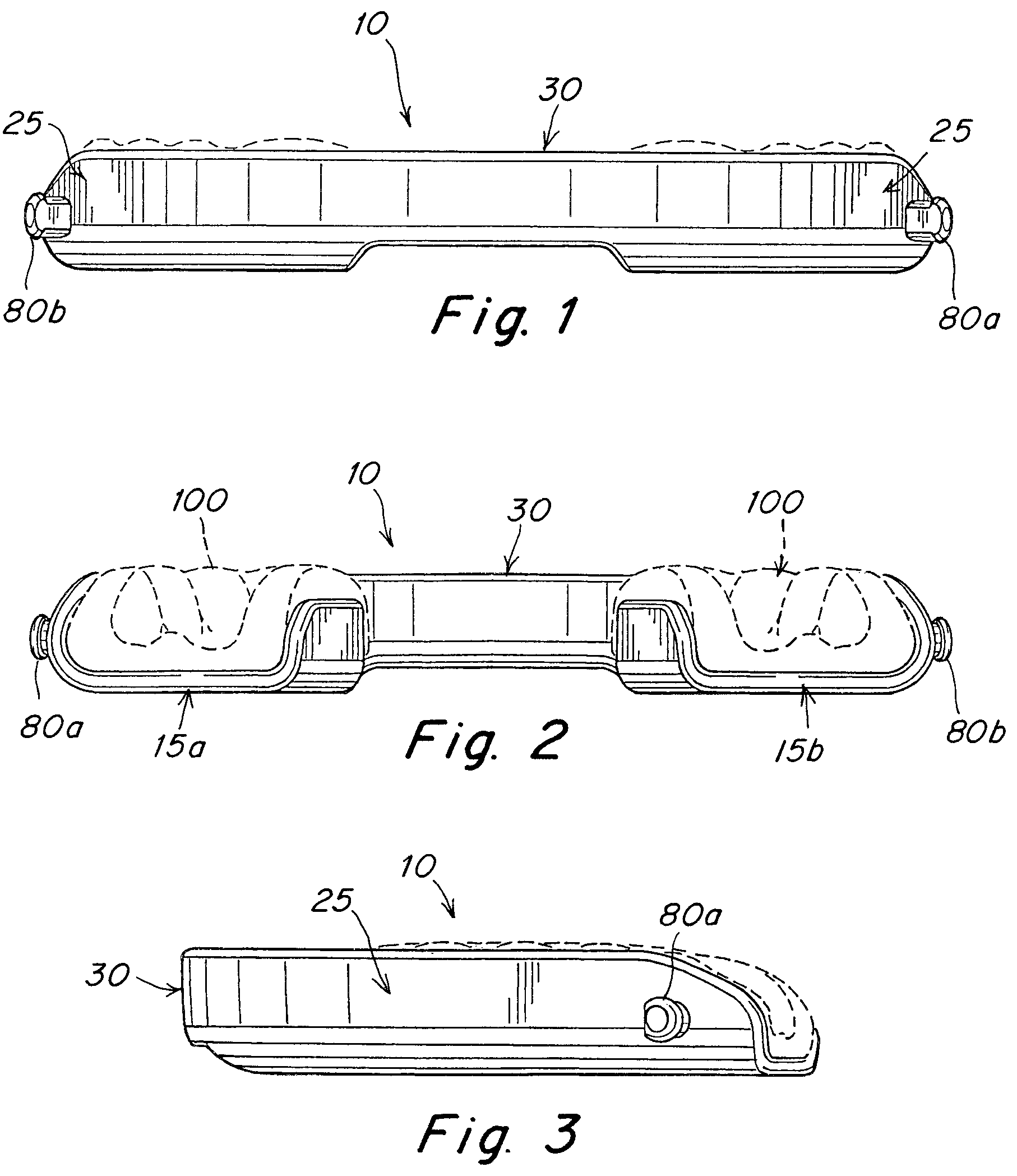 Patent US12102555 Figure 1 – Oral appliance