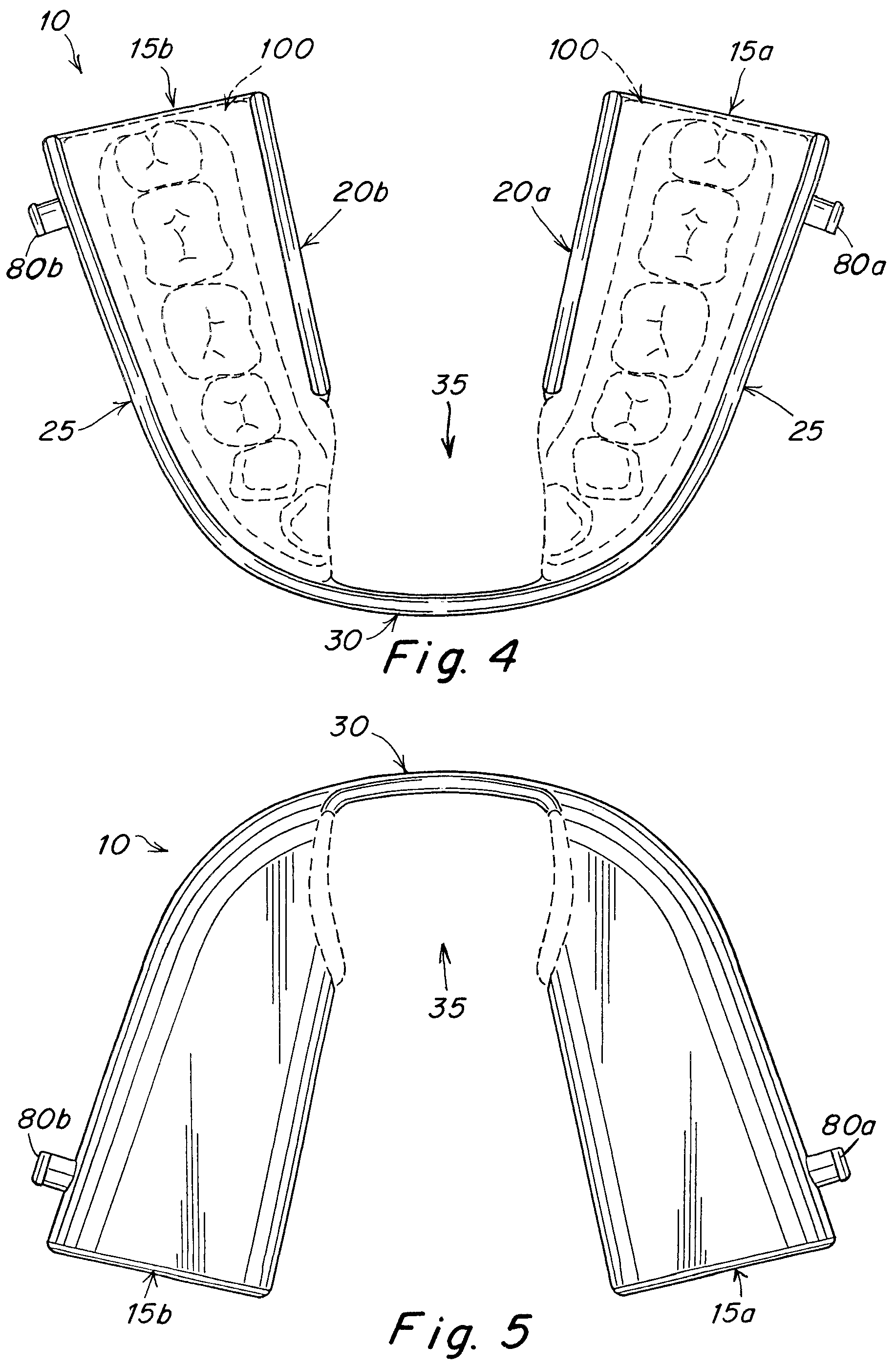 Patent US12102555 Figure 2 – Oral appliance