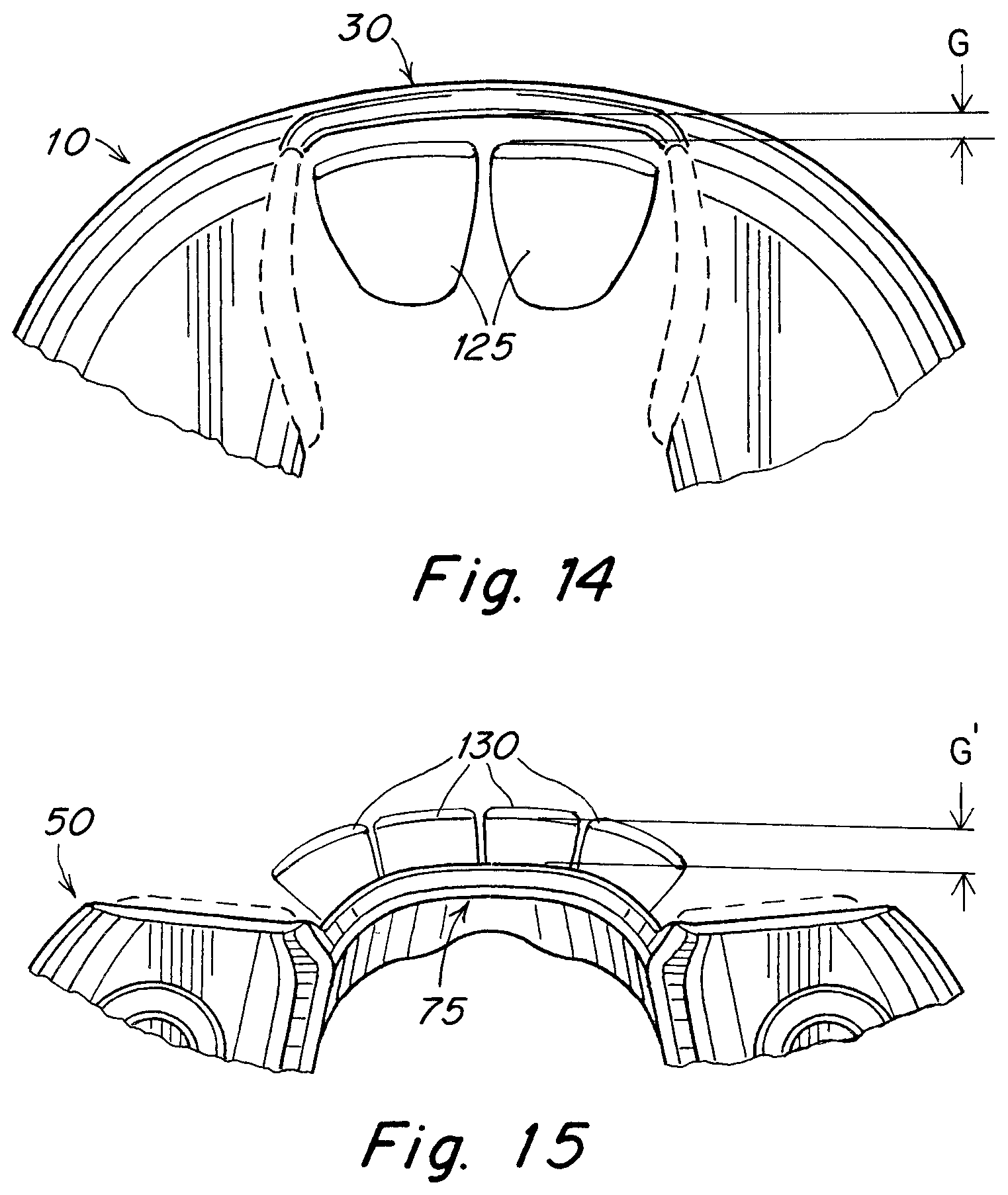 Patent US12102555 Figure 6 – Oral appliance