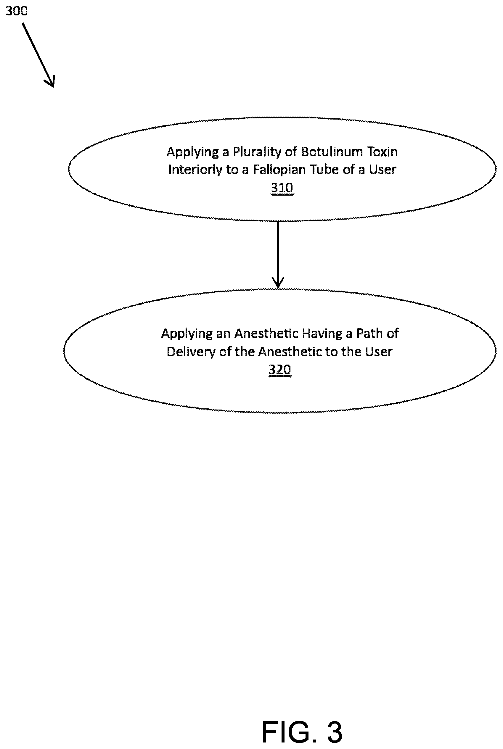 Patent US12102556 Figure 3 – System and method for fallopian birth control