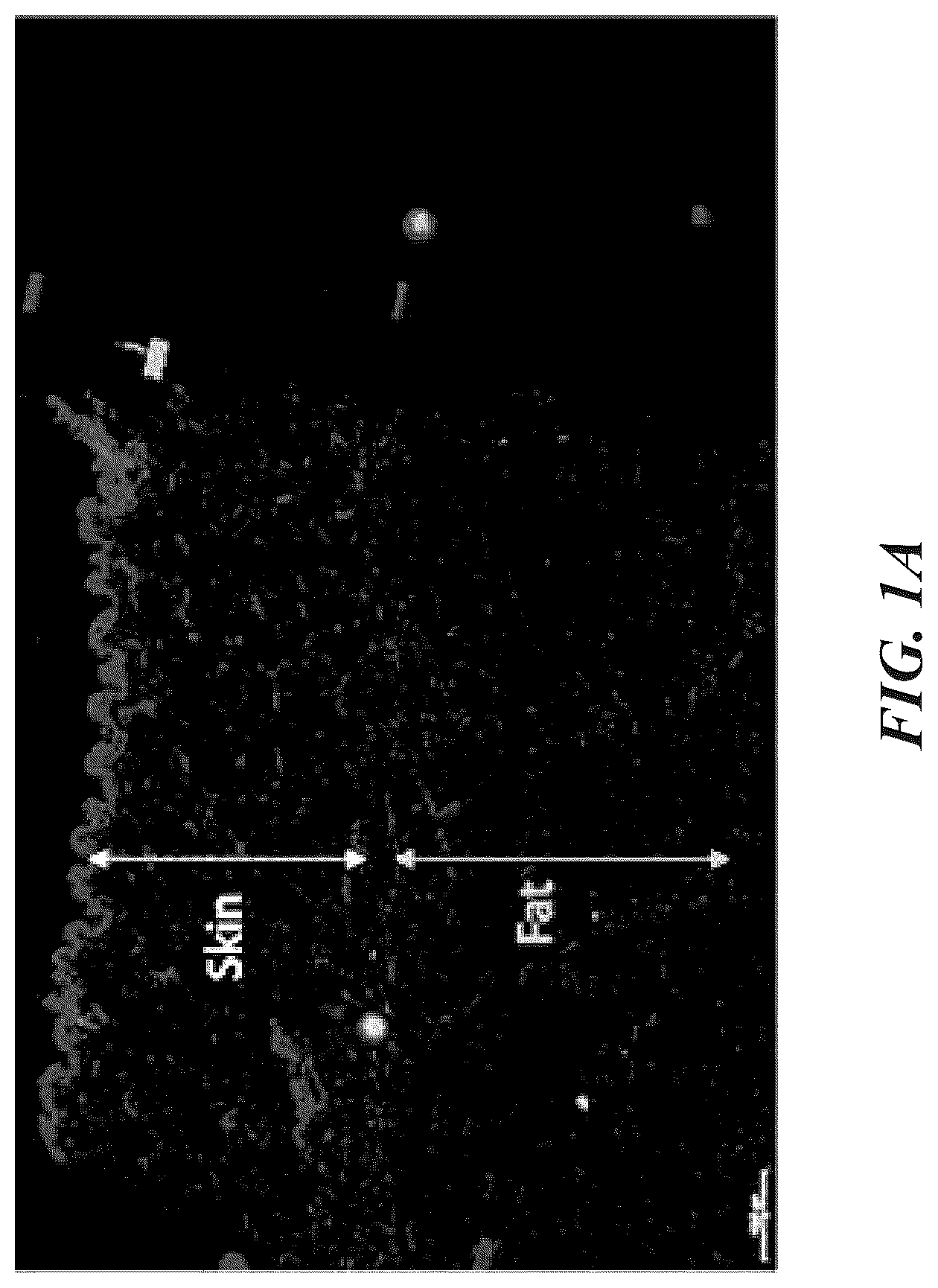 Patent US12102557 — Methods, devices, and systems for improving skin characteristics — Figure 1