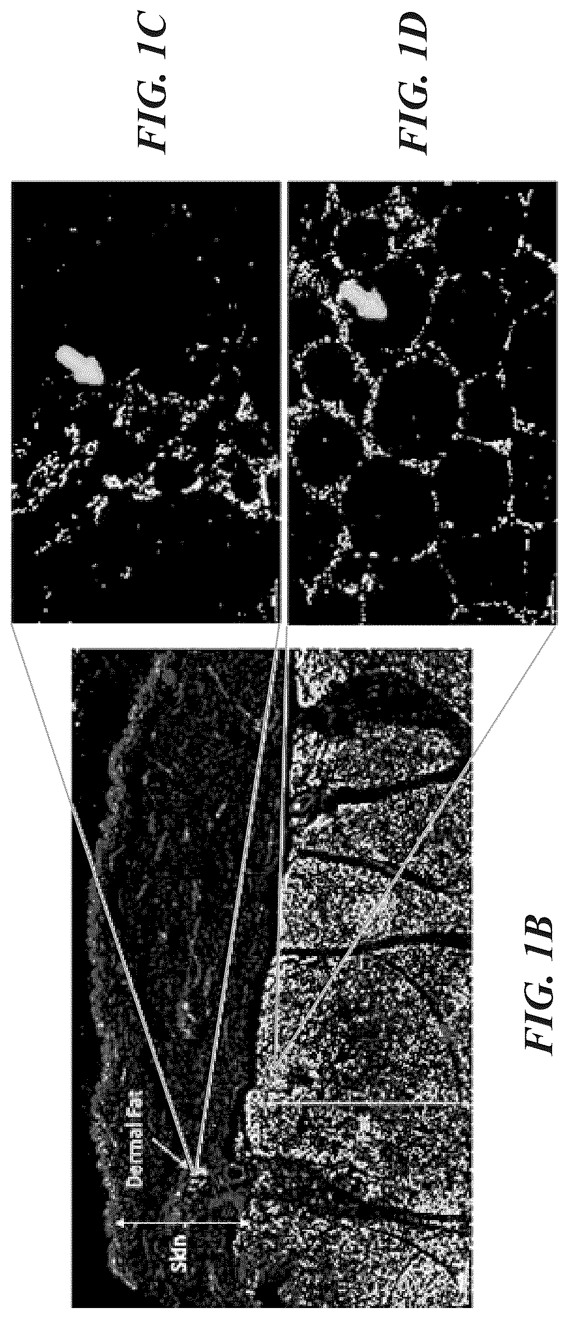 Patent US12102557 Figure 2 – Methods, devices, and systems for improving skin characteristics