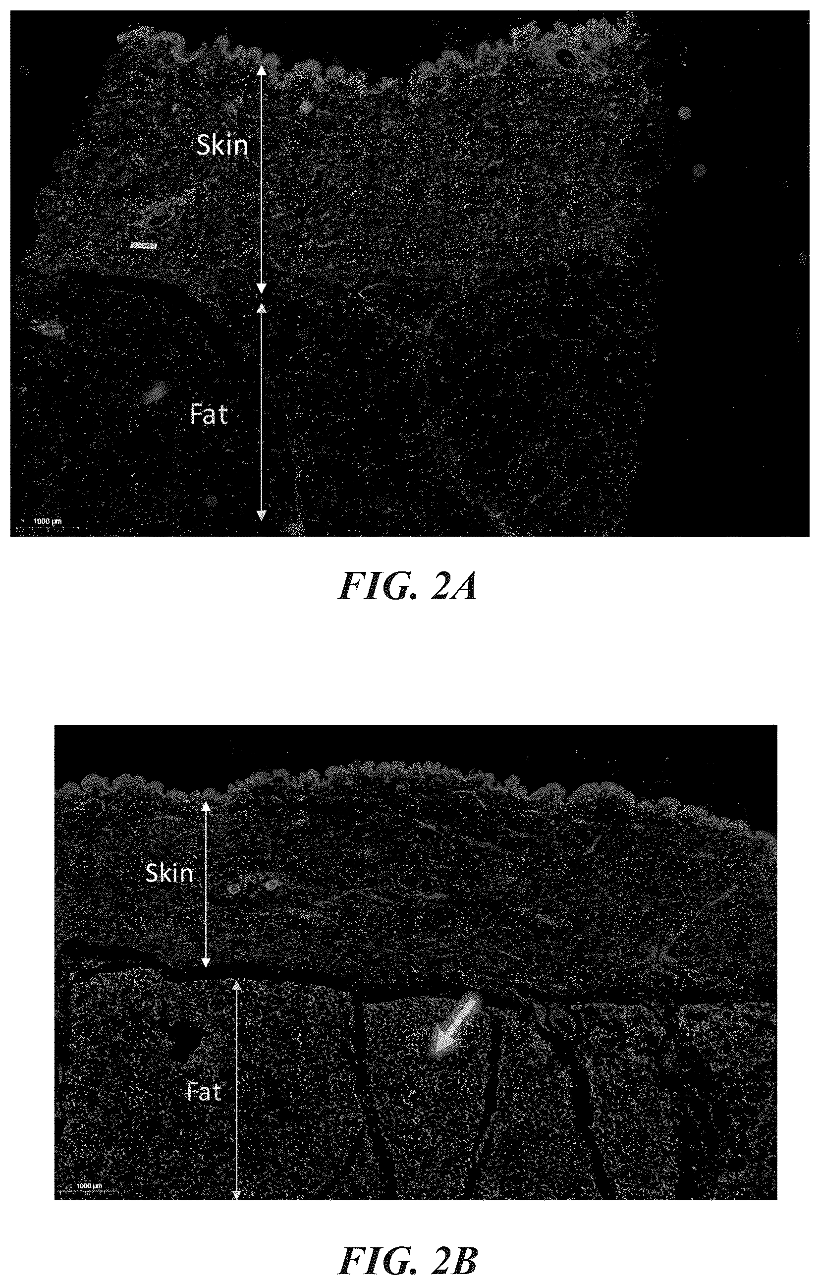 Patent US12102557 Figure 3 – Methods, devices, and systems for improving skin characteristics