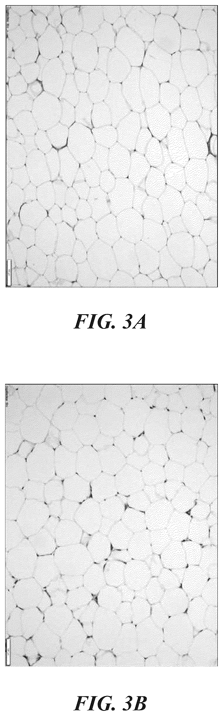 Patent US12102557 Figure 4 – Methods, devices, and systems for improving skin characteristics