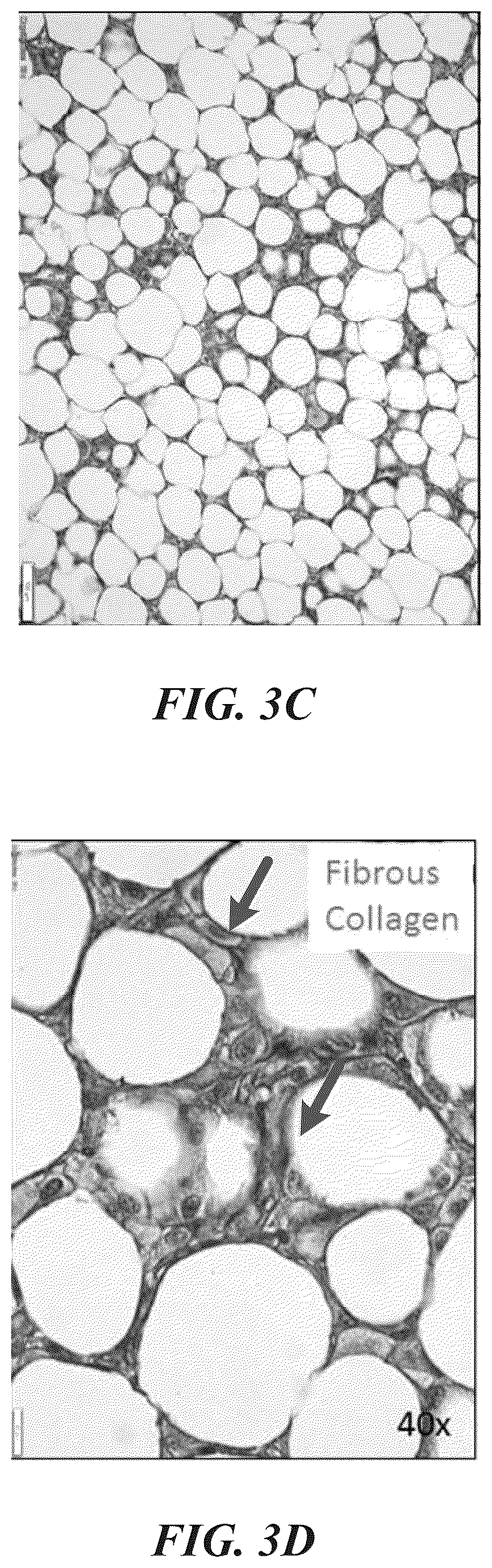 Patent US12102557 Figure 5 – Methods, devices, and systems for improving skin characteristics