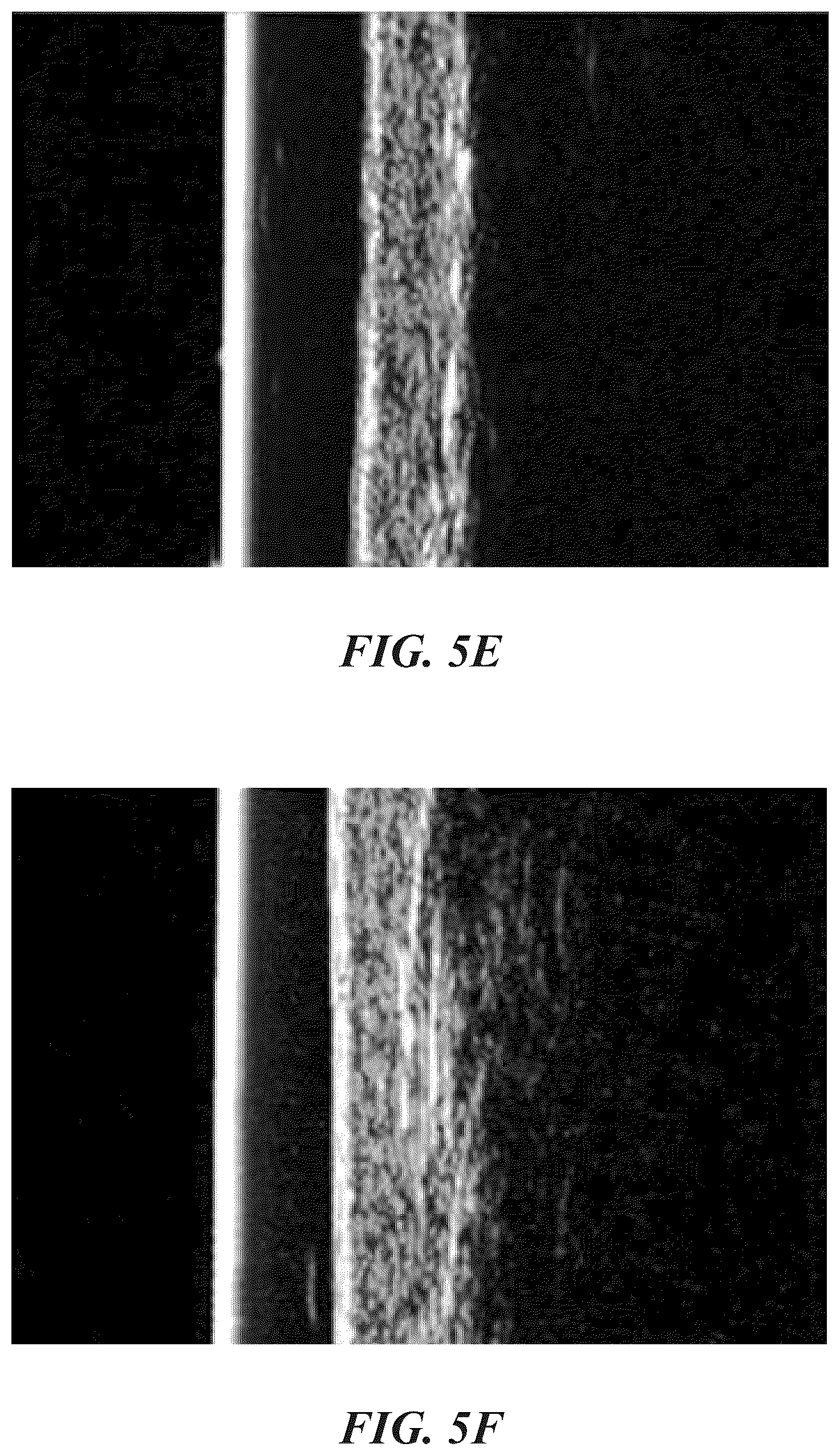 Patent US12102557 Figure 9 – Methods, devices, and systems for improving skin characteristics