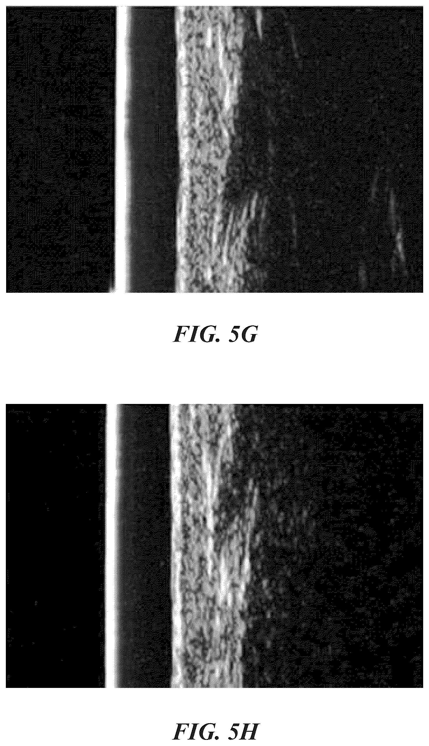 Patent US12102557 Figure 10 – Methods, devices, and systems for improving skin characteristics