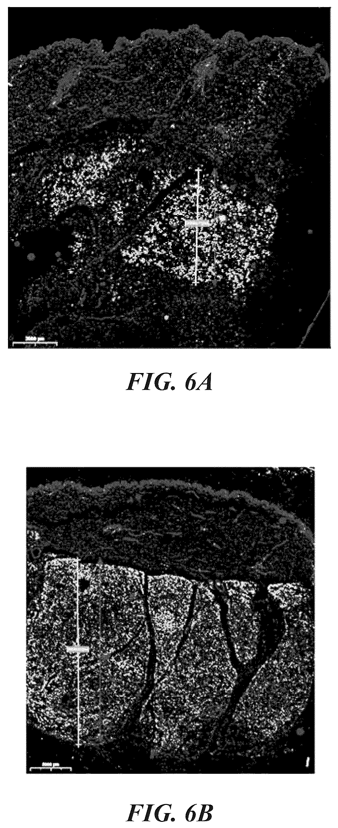 Patent US12102557 Figure 11 – Methods, devices, and systems for improving skin characteristics