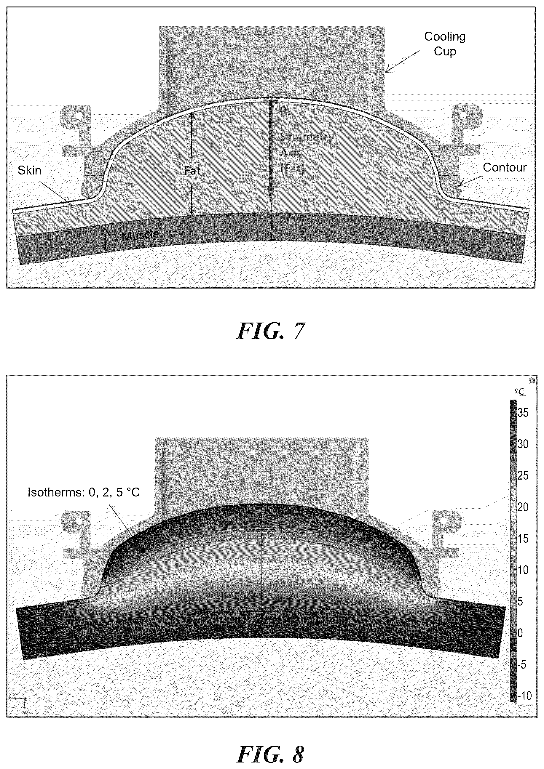 Patent US12102557 Figure 13 – Methods, devices, and systems for improving skin characteristics