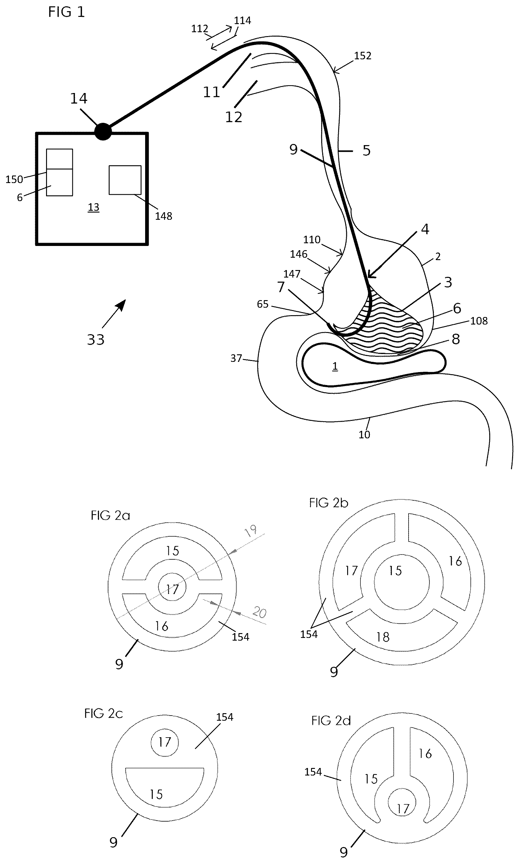 Patent US12102558 — Apparatus and method for cooling and/or heating an organ — Figure 1
