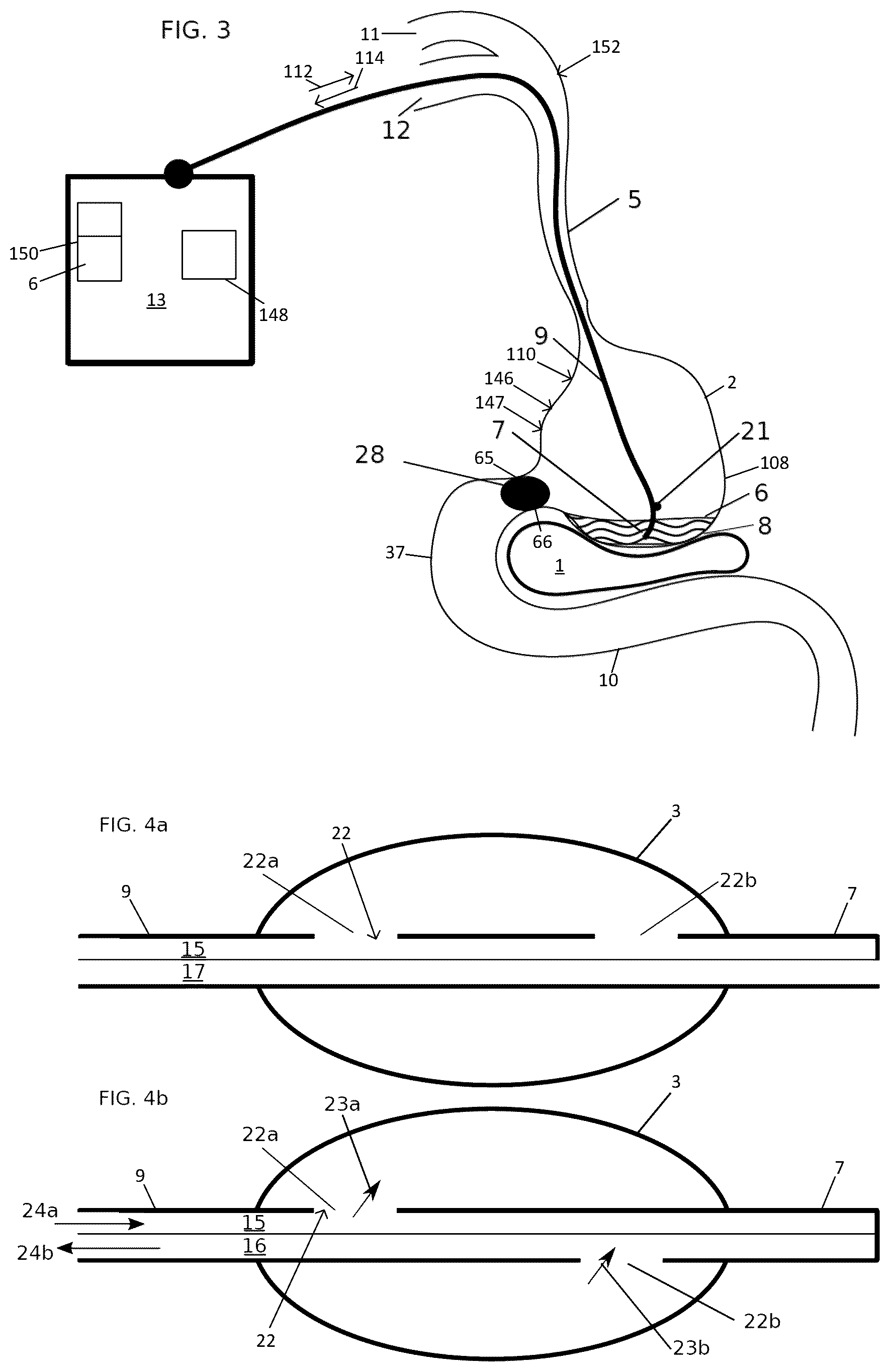 Patent US12102558 Figure 2 – Apparatus and method for cooling and/or heating an organ