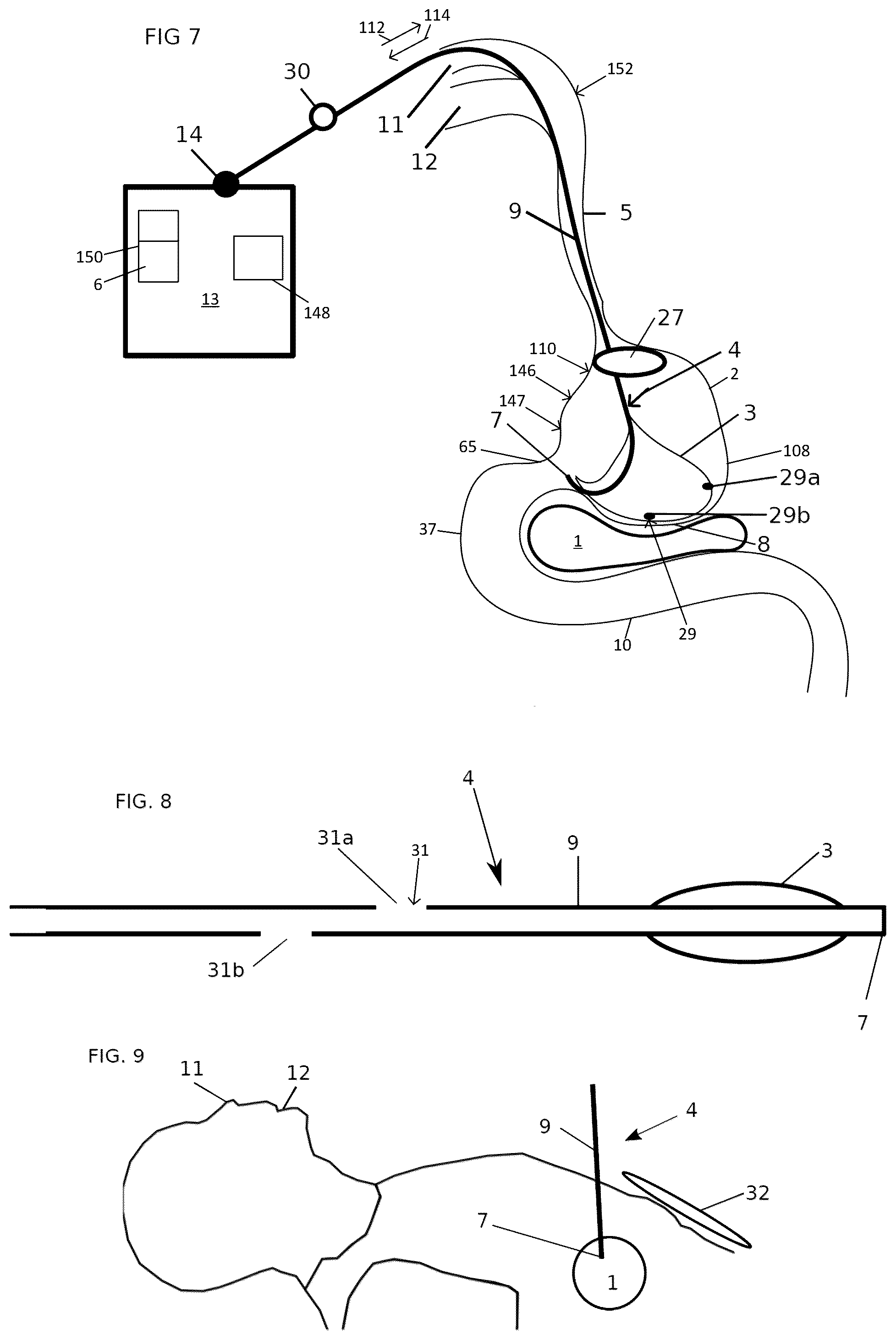 Patent US12102558 Figure 4 – Apparatus and method for cooling and/or heating an organ